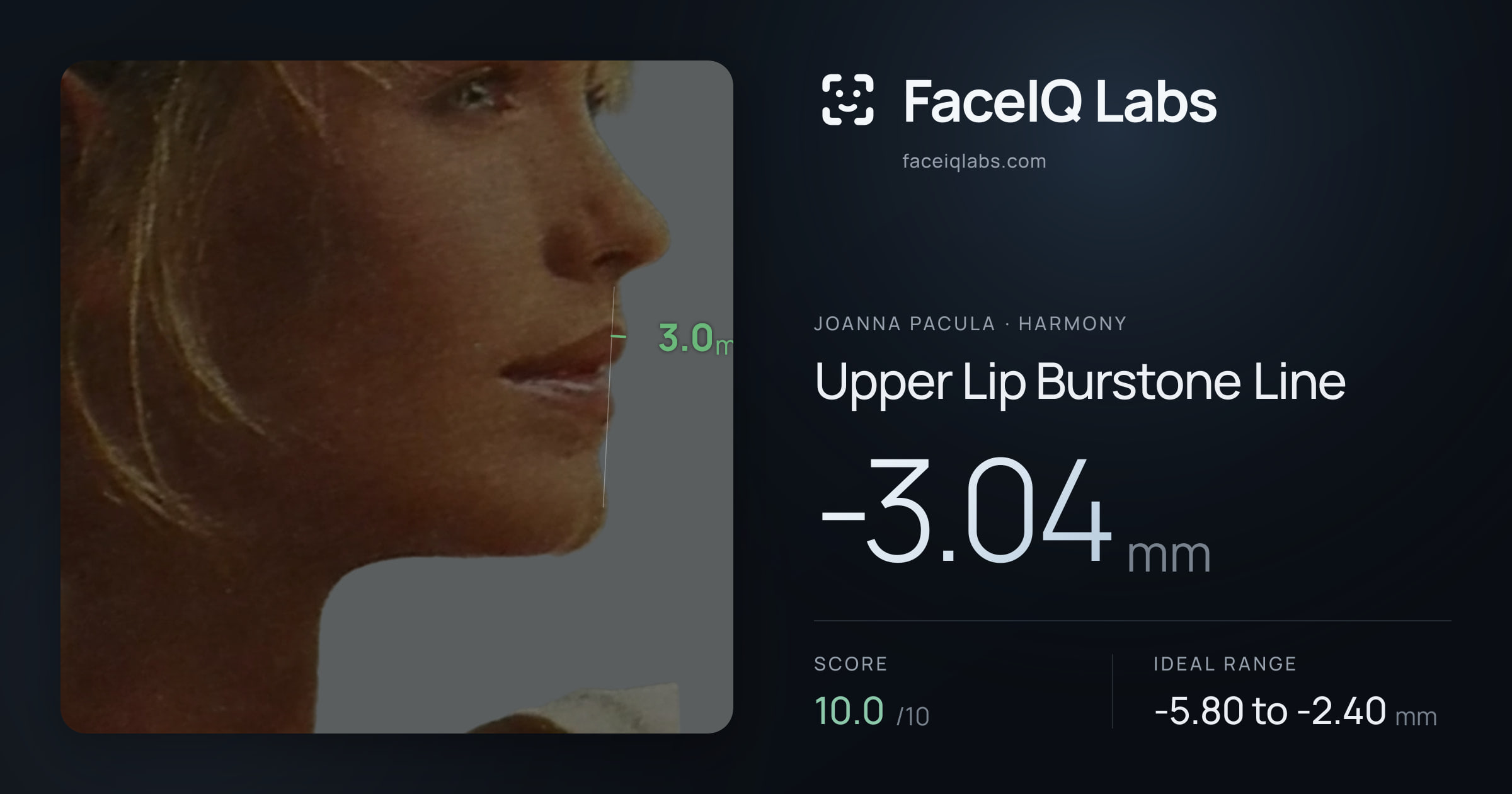 Joanna Pacula Upper Lip Burstone Line: -3.04mm, drawn on the photo