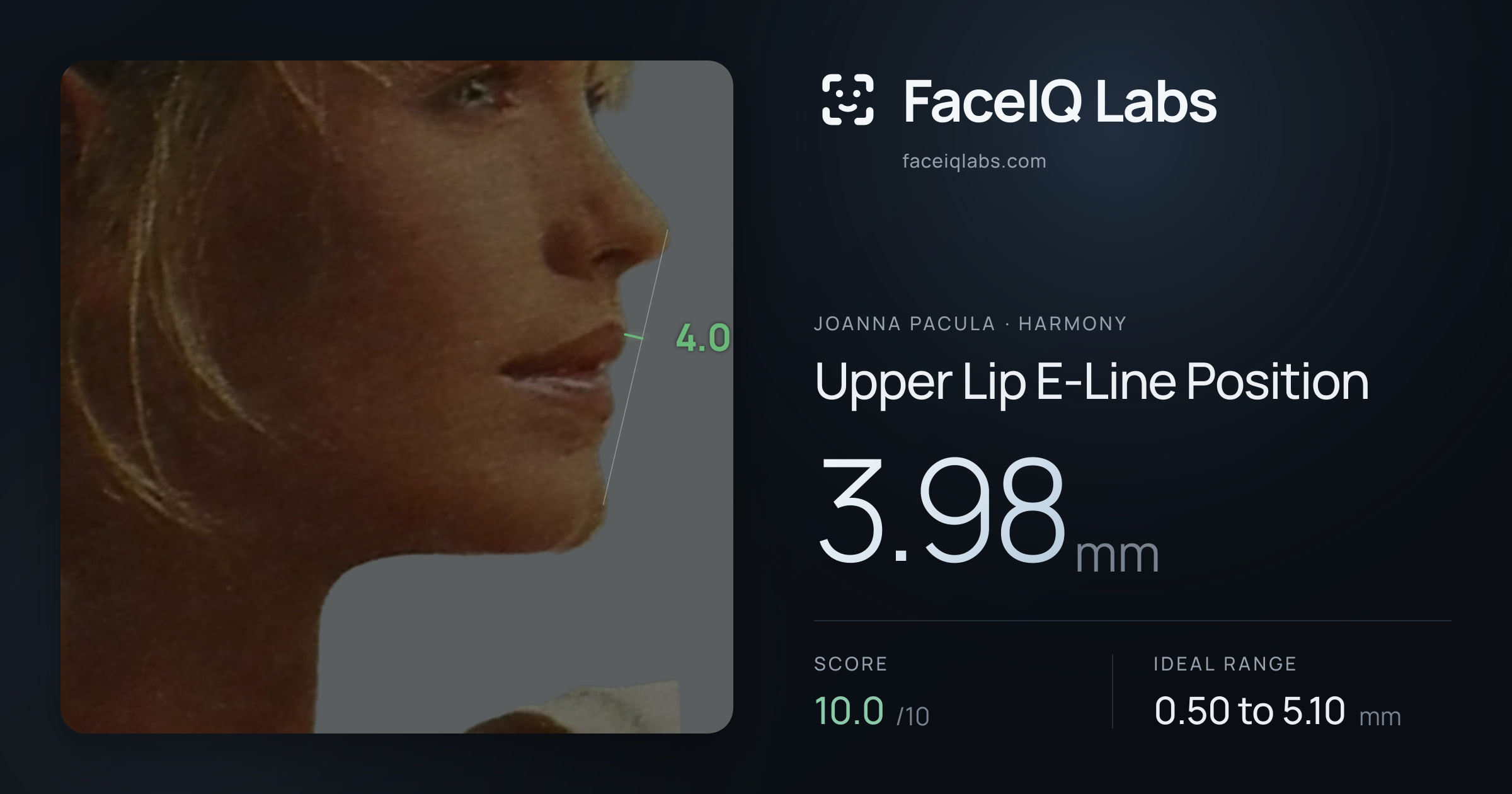 Joanna Pacula Upper Lip E-Line Position: 3.98mm, drawn on the photo