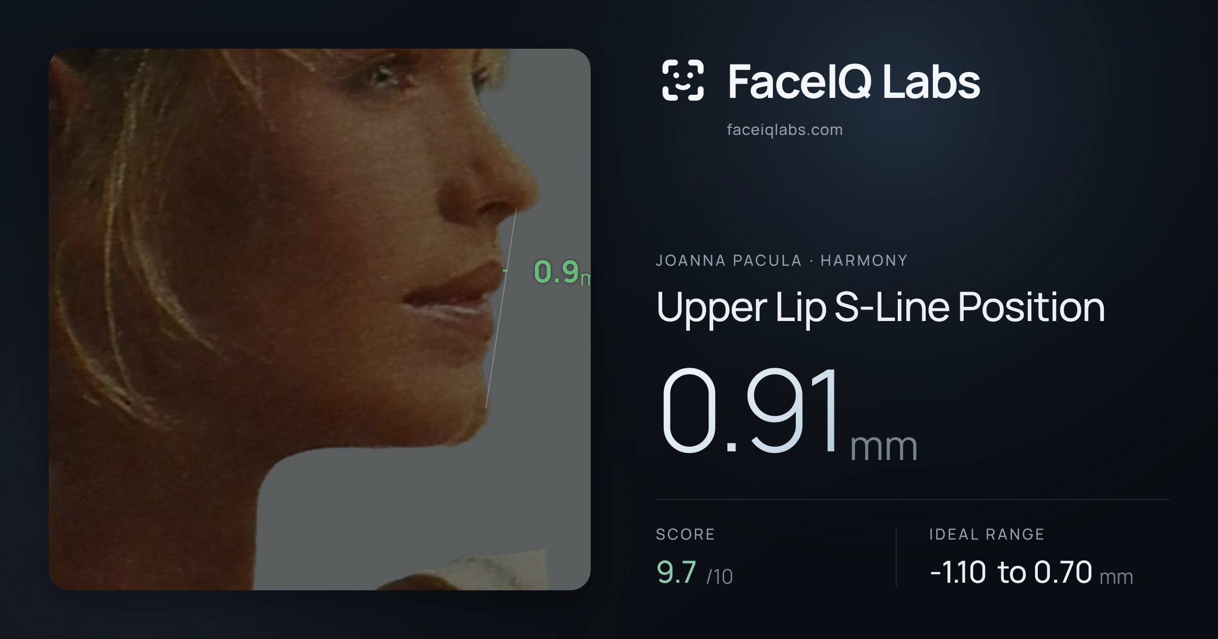Joanna Pacula Upper Lip S-Line Position: 0.91mm, drawn on the photo