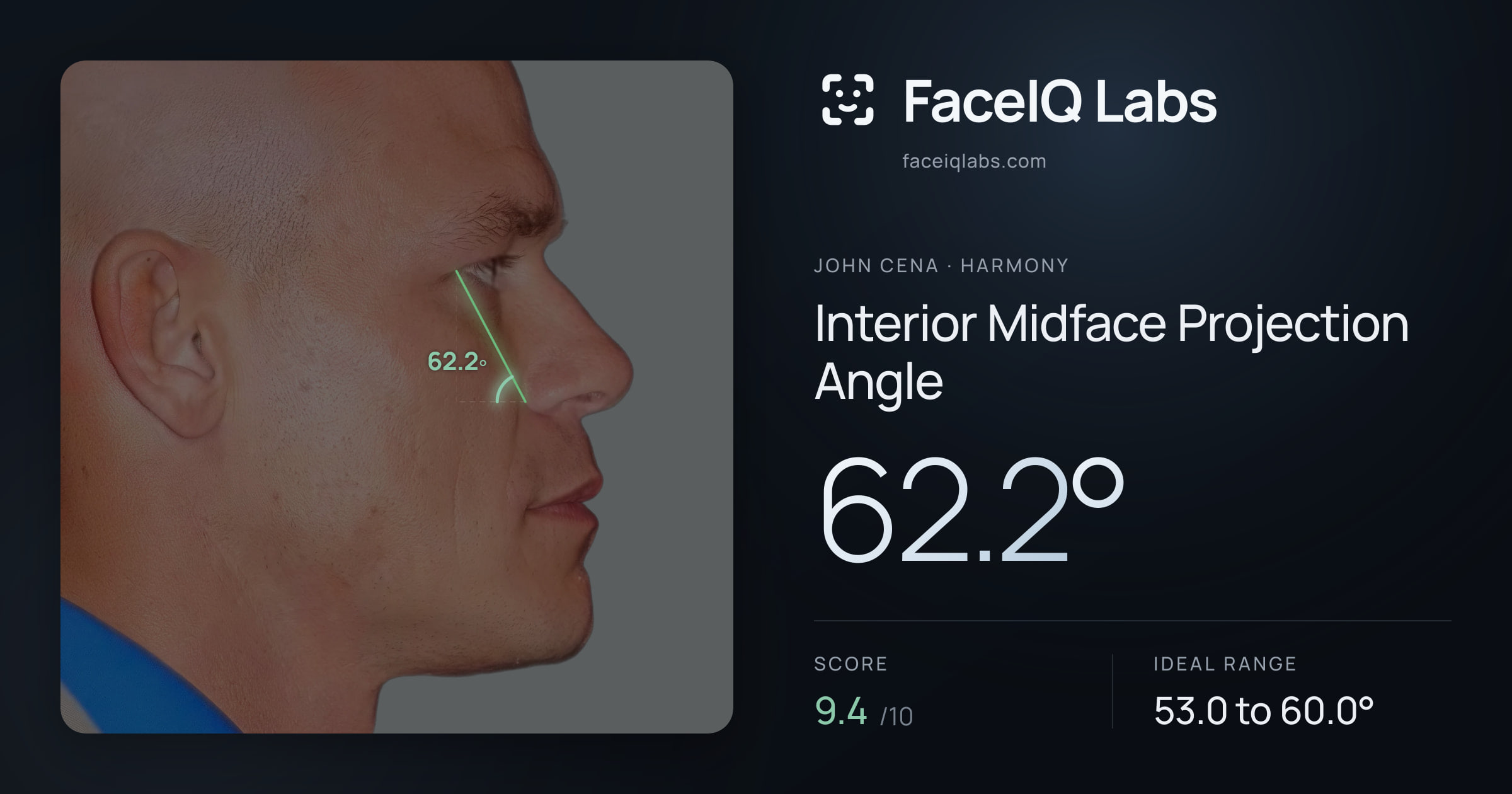John Cena Interior Midface Projection Angle: 62.2°, drawn on the photo