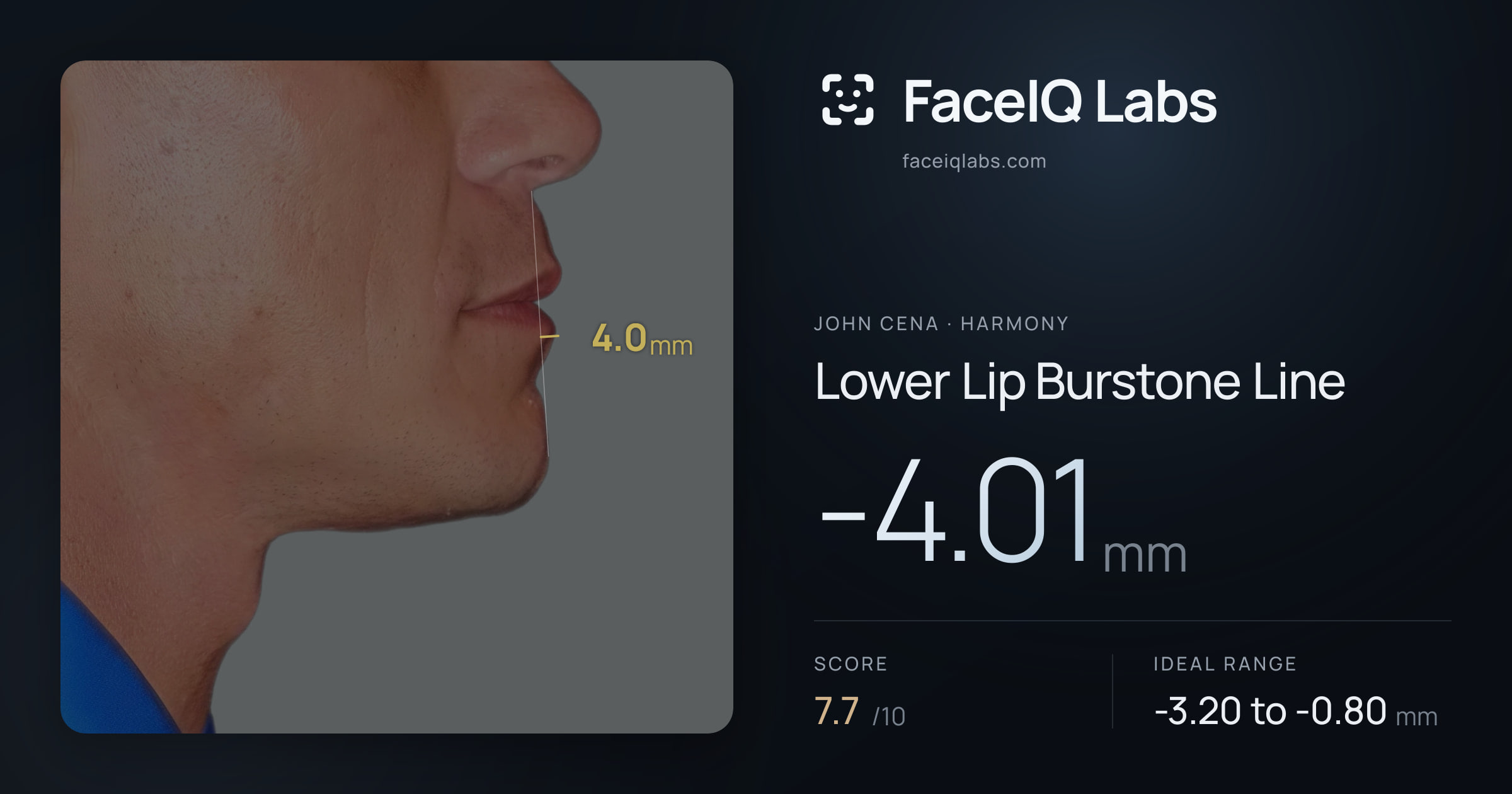 John Cena Lower Lip Burstone Line: -4.01mm, drawn on the photo