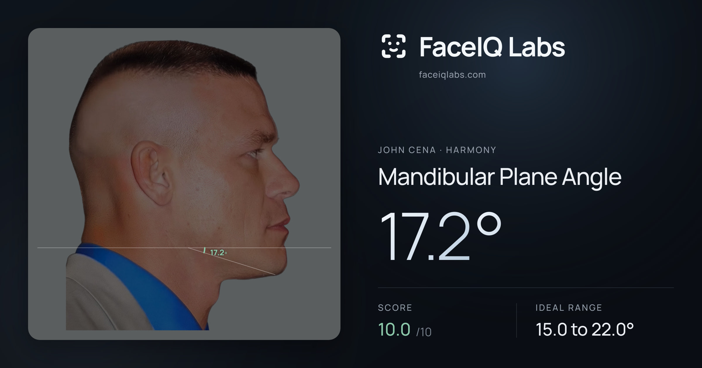 John Cena Mandibular Plane Angle: 17.2°, drawn on the photo