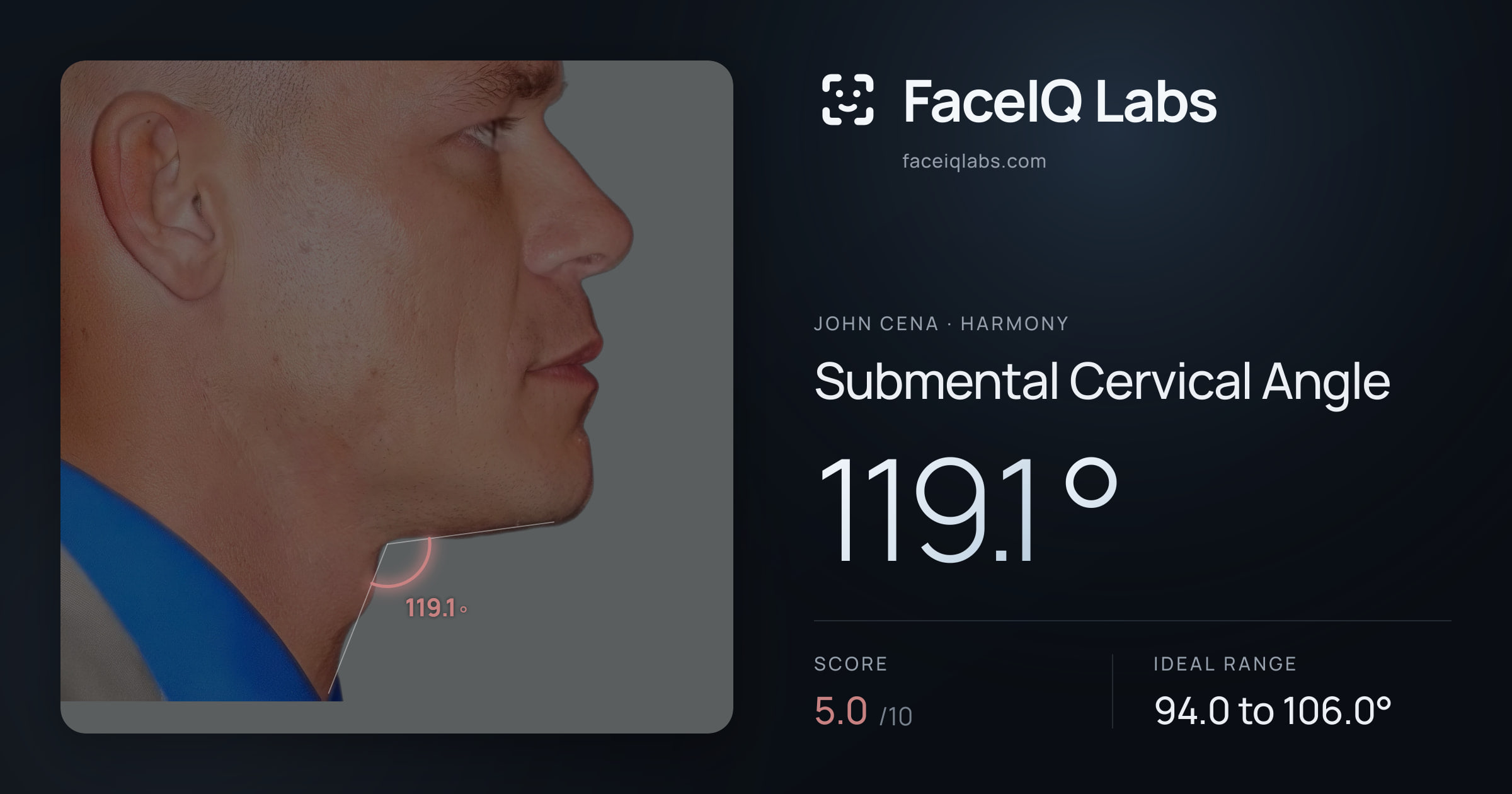 John Cena Submental Cervical Angle: 119.1°, drawn on the photo
