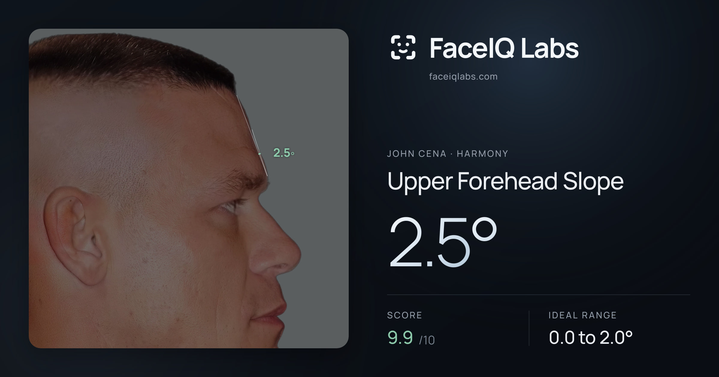 John Cena Upper Forehead Slope: 2.5°, drawn on the photo