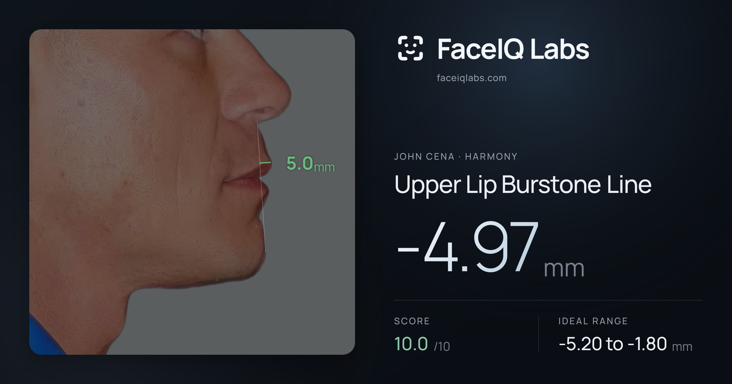 John Cena Upper Lip Burstone Line: -4.97mm, drawn on the photo