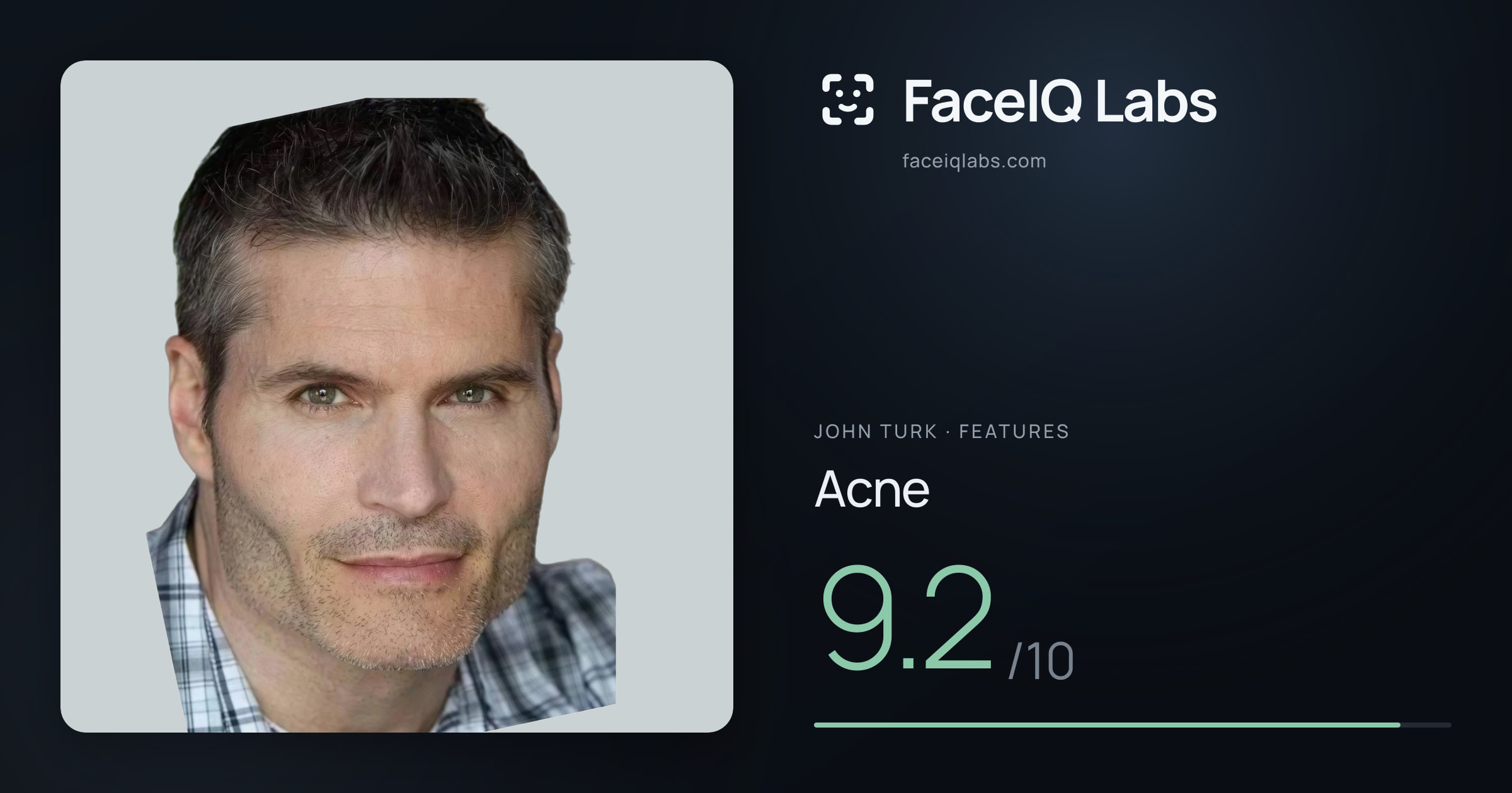John Turk Acne: 9.2/10, drawn on the photo