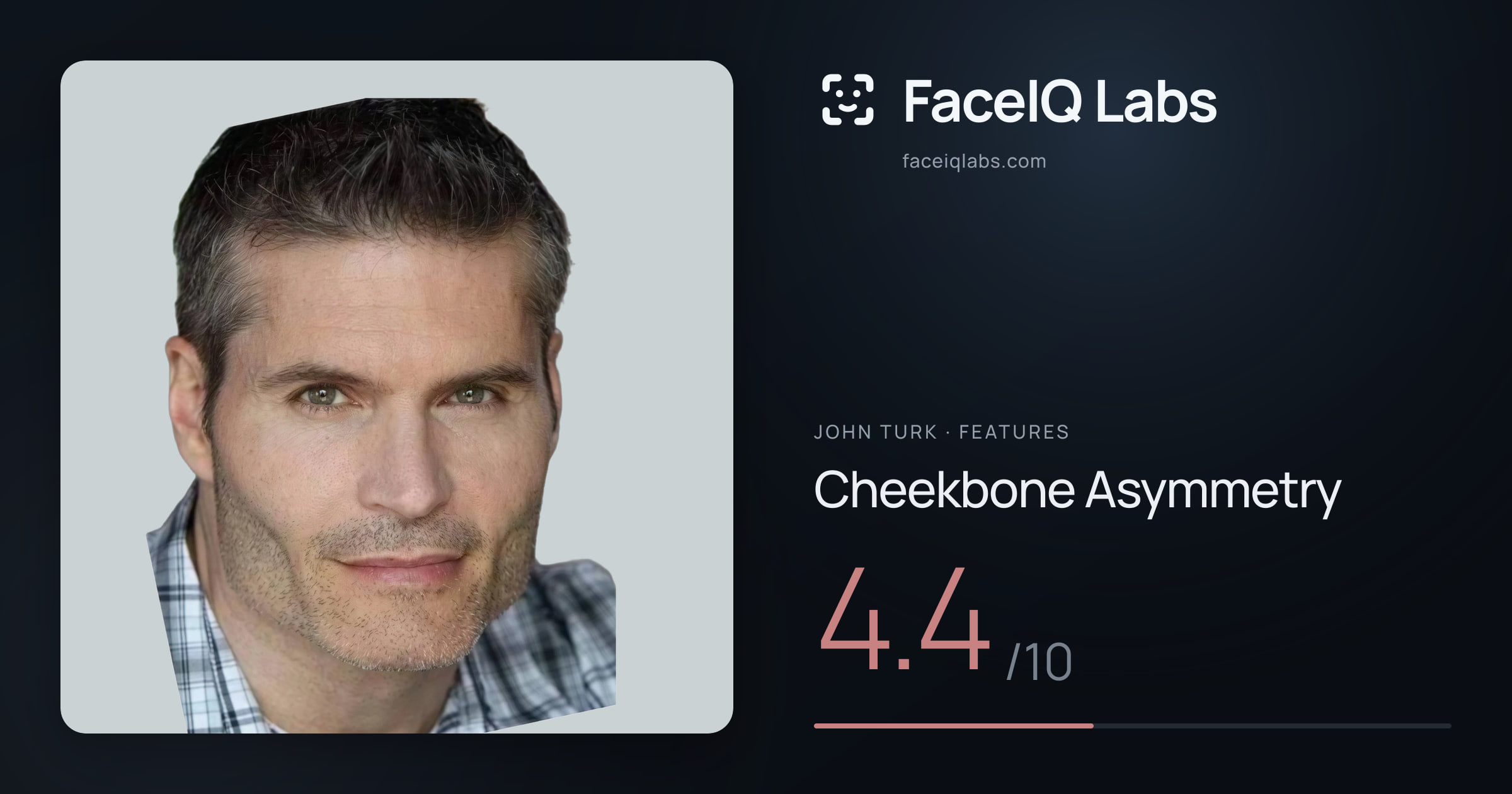 John Turk Cheekbone Asymmetry: 4.4/10, drawn on the photo