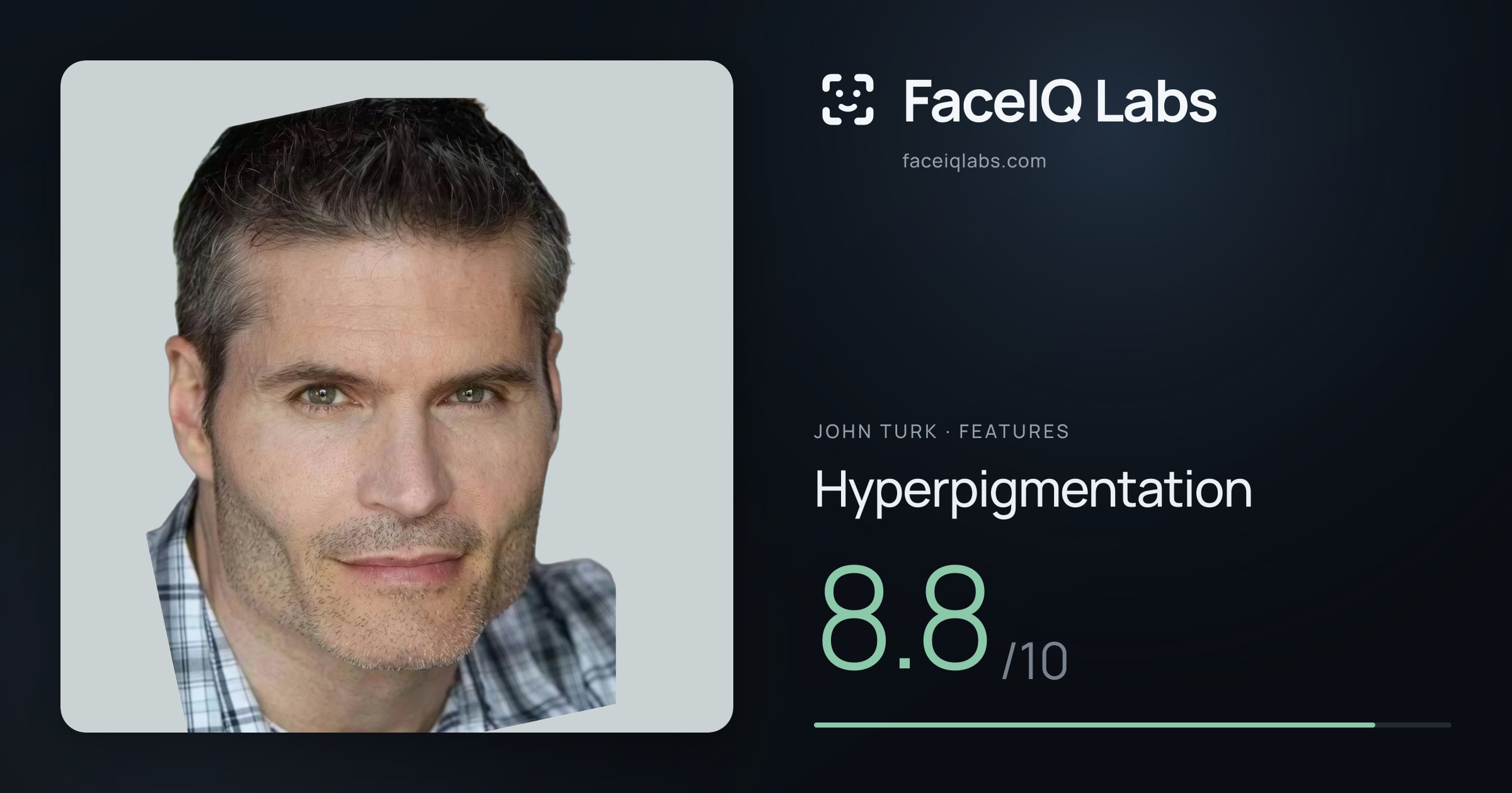 John Turk Hyperpigmentation: 8.8/10, drawn on the photo