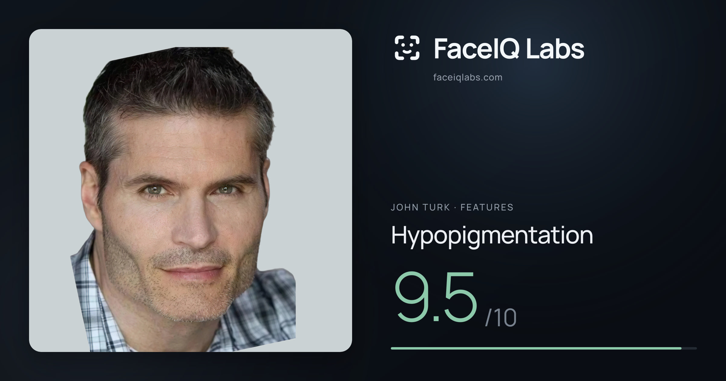 John Turk Hypopigmentation: 9.5/10, drawn on the photo