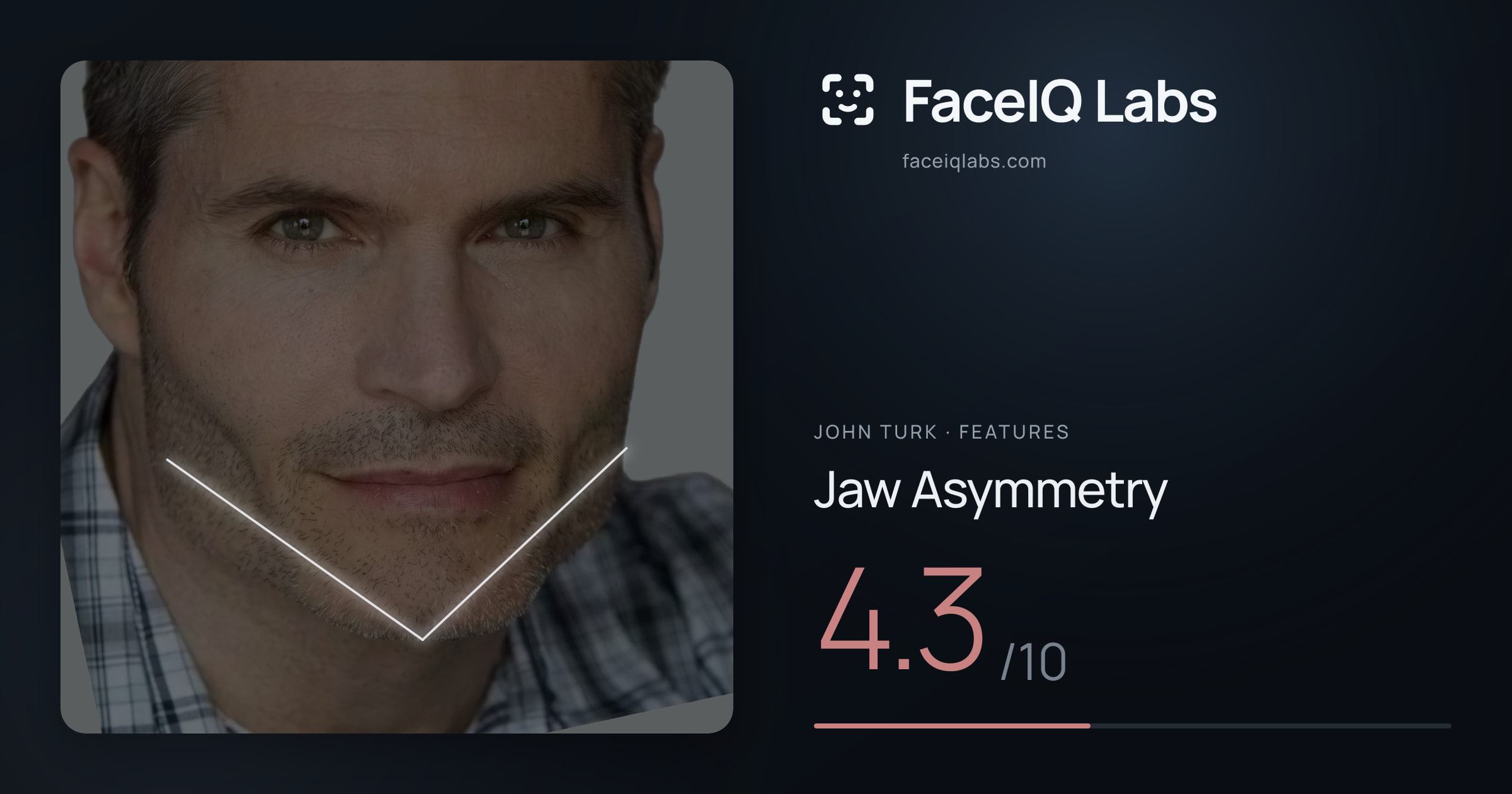John Turk Jaw Asymmetry: 4.3/10, drawn on the photo