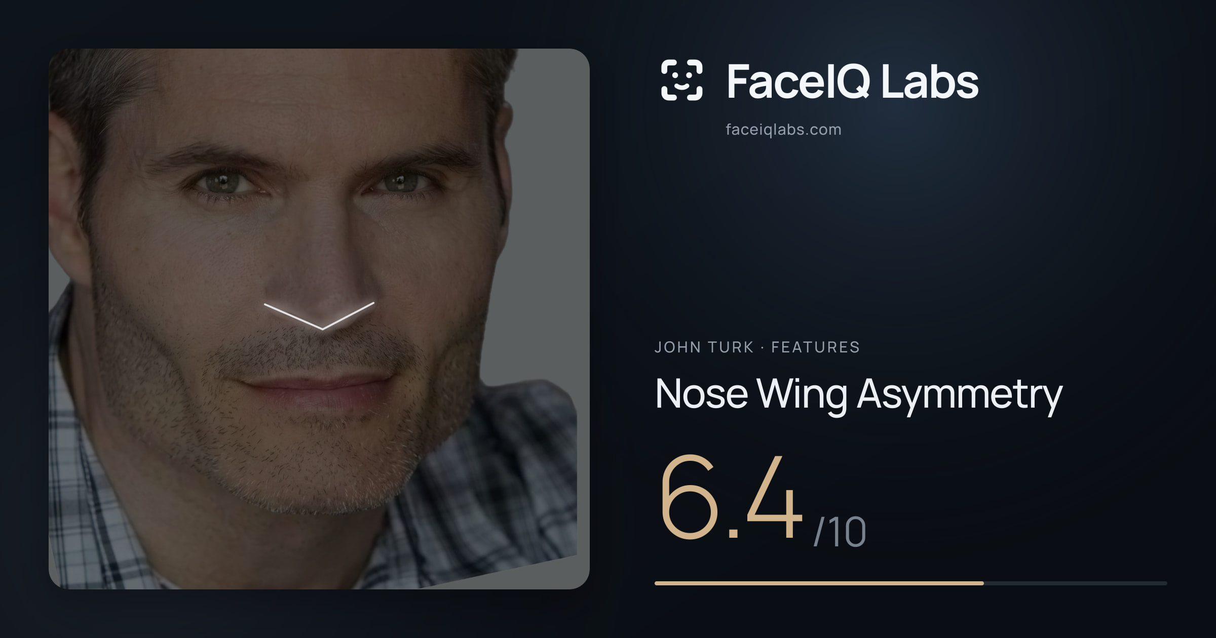John Turk Nose Wing Asymmetry: 6.4/10, drawn on the photo