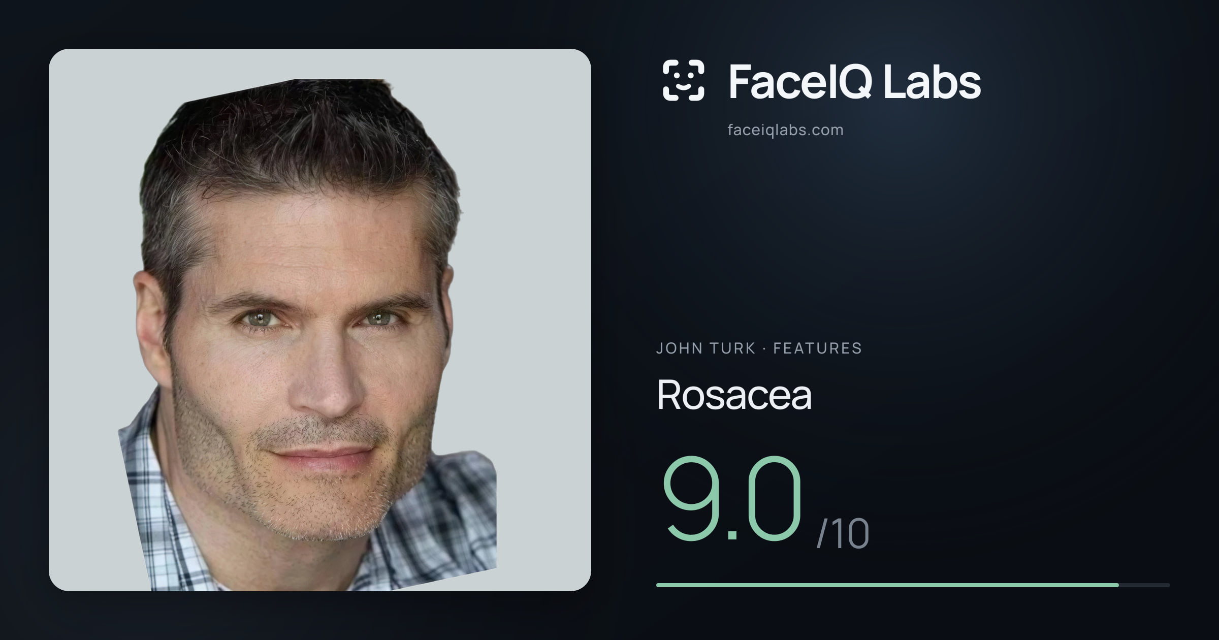 John Turk Rosacea: 9.0/10, drawn on the photo