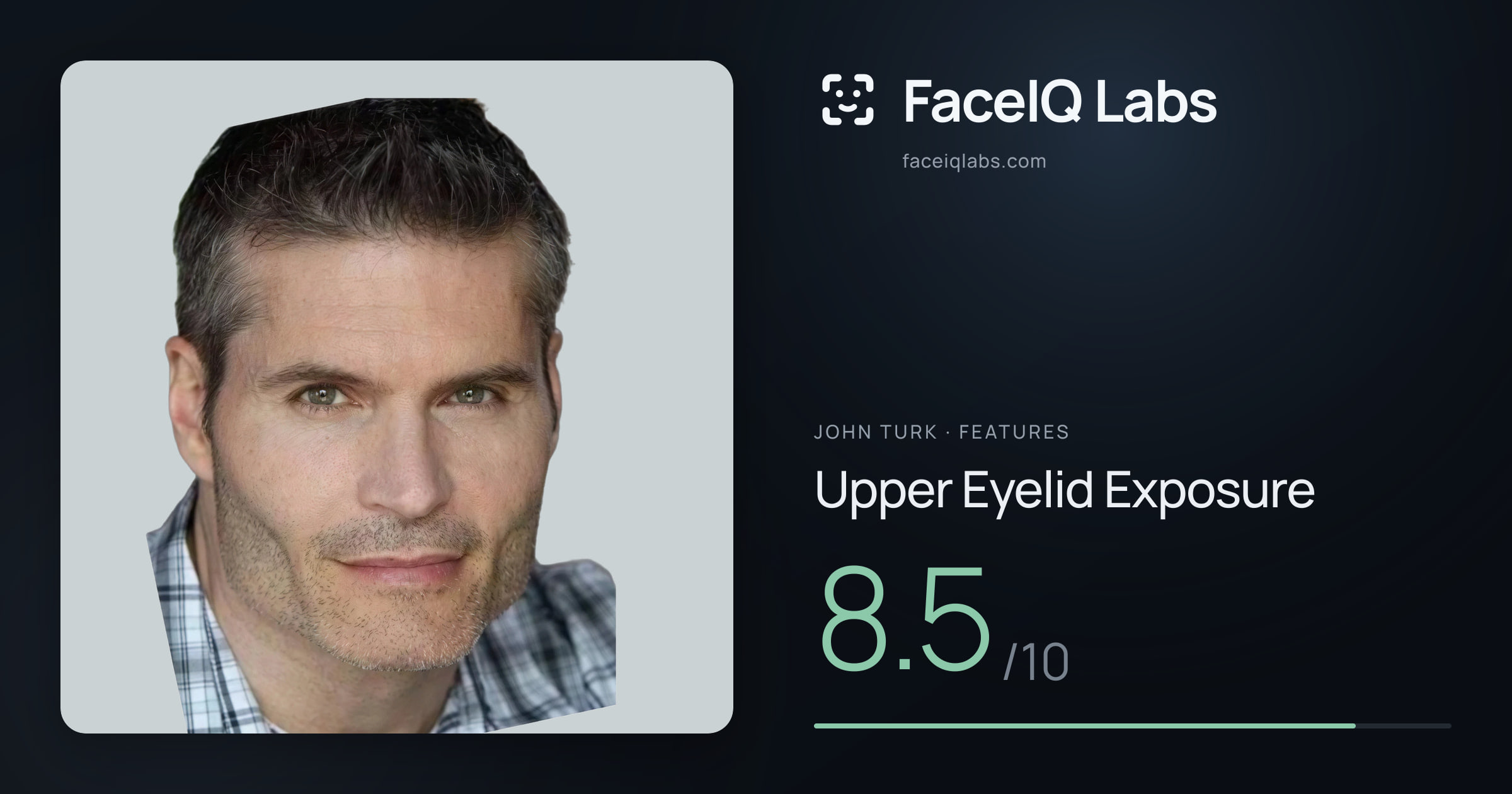 John Turk Upper Eyelid Exposure: 8.5/10, drawn on the photo