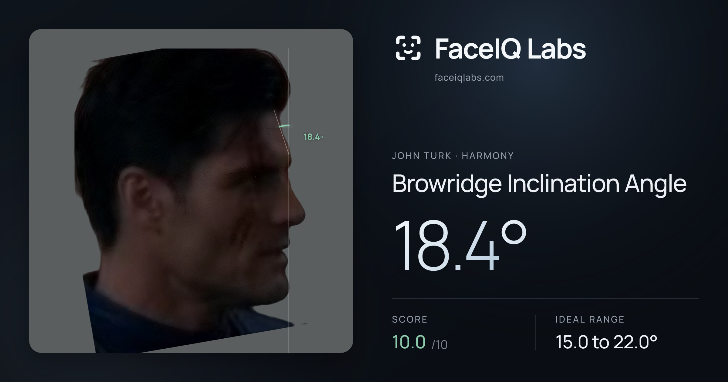 John Turk Browridge Inclination Angle: 18.4°, drawn on the photo