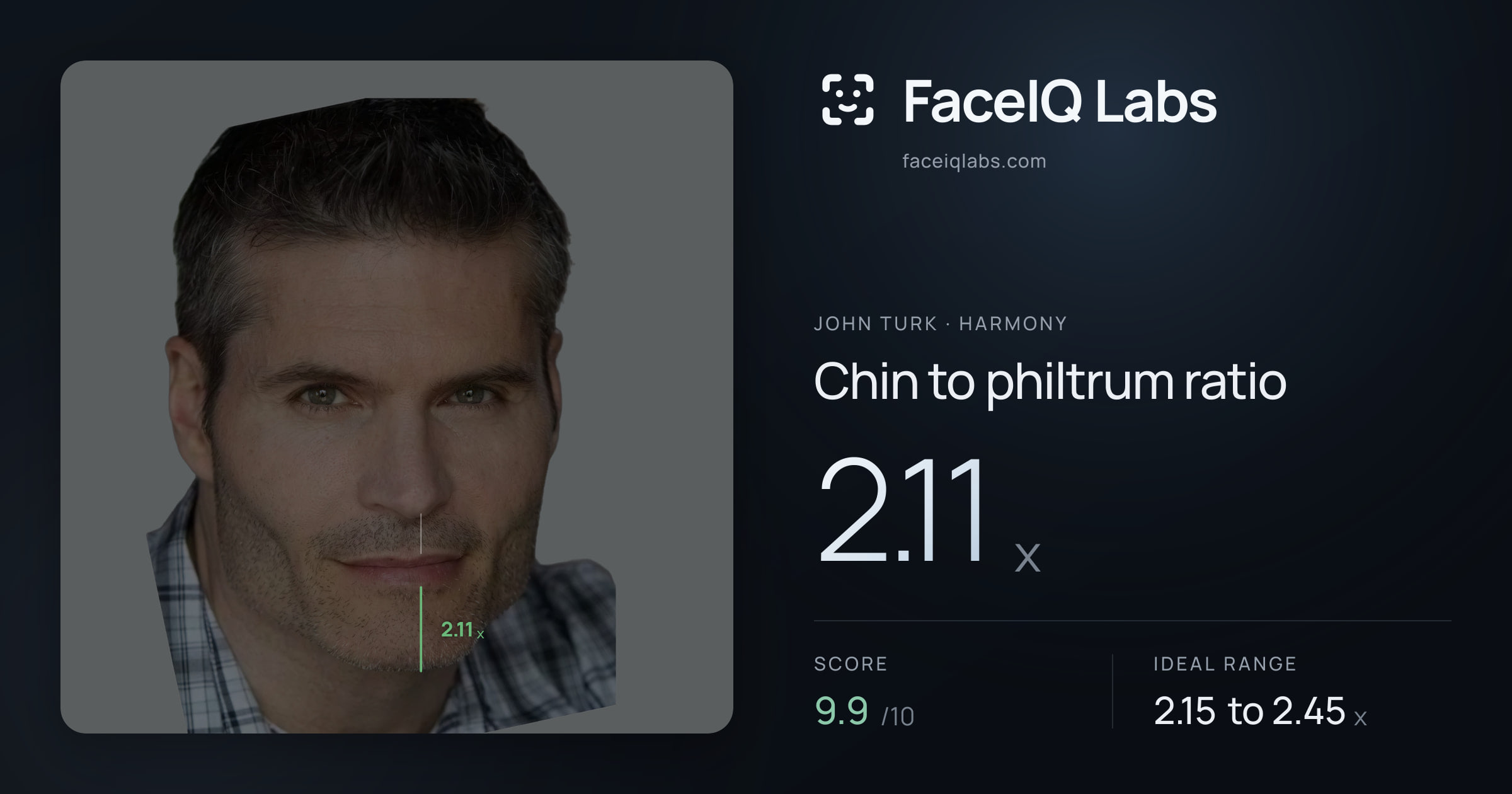 John Turk Chin to philtrum ratio: 2.11x, drawn on the photo