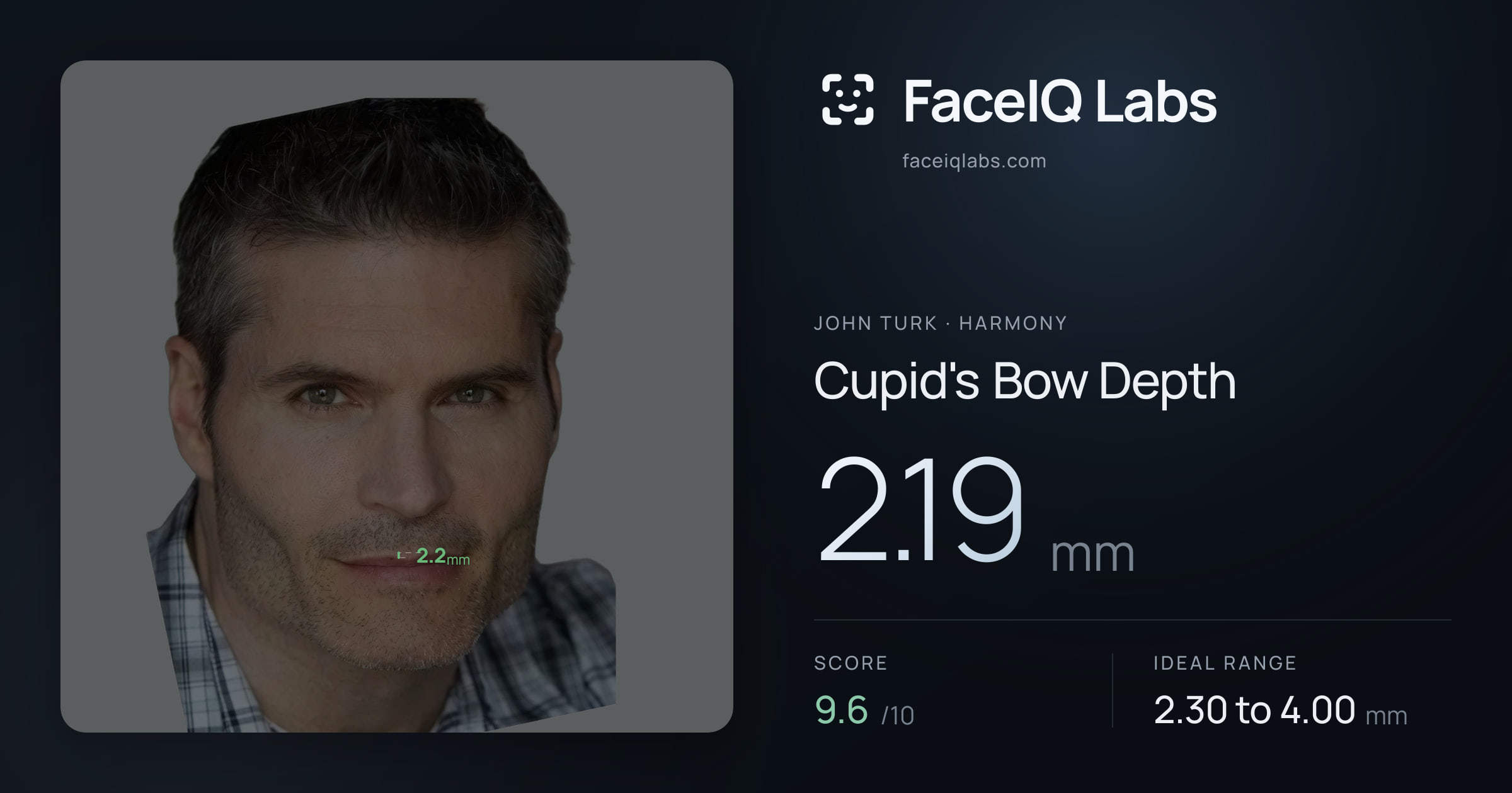 John Turk Cupid's Bow Depth: 2.19mm, drawn on the photo