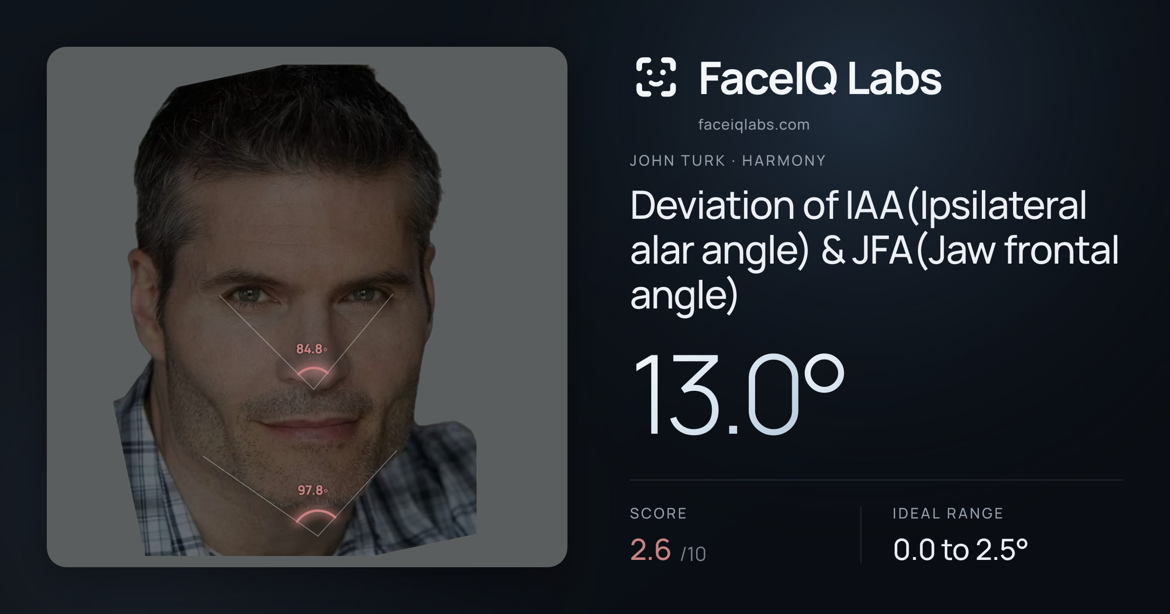 John Turk Deviation of IAA(Ipsilateral alar angle) & JFA(Jaw frontal angle): 13.0°, drawn on the photo