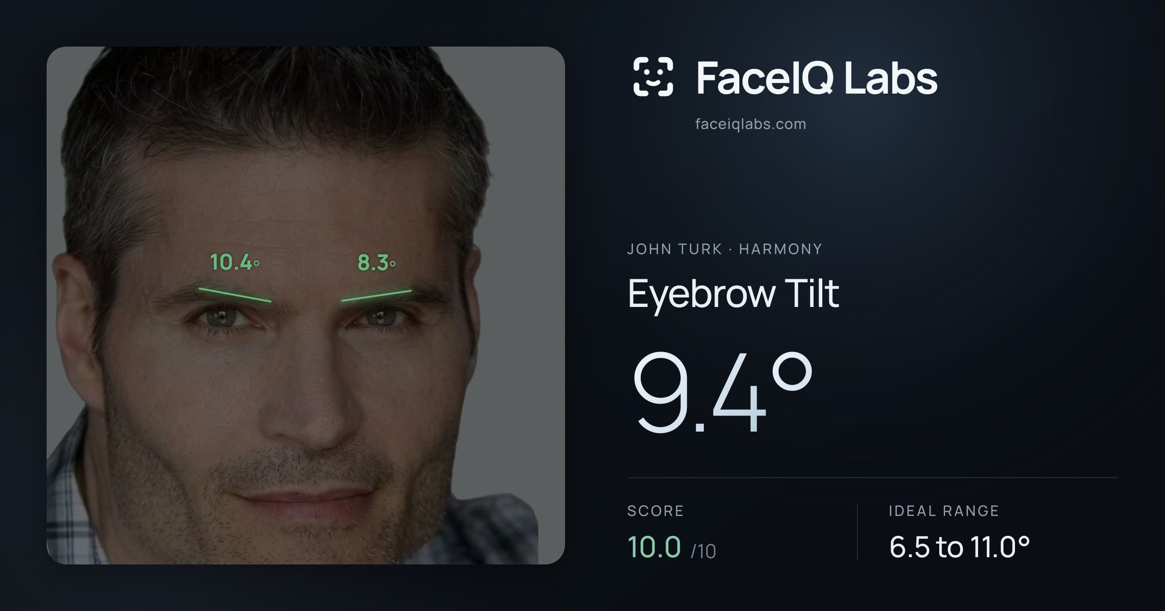 John Turk Eyebrow Tilt: 9.4°, drawn on the photo
