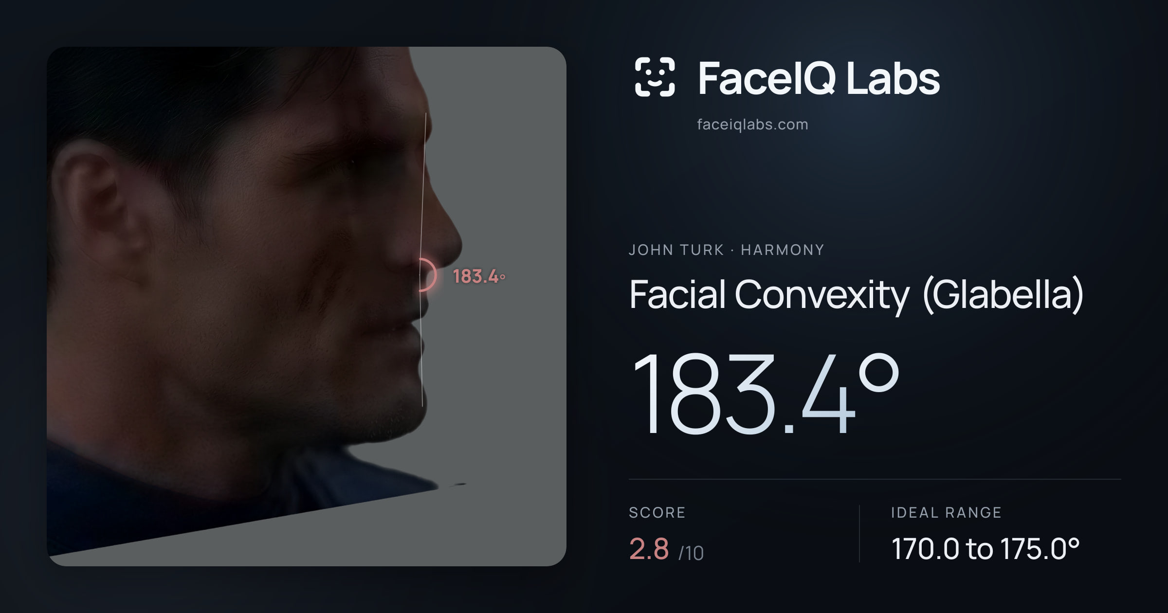 John Turk Facial Convexity (Glabella): 183.4°, drawn on the photo
