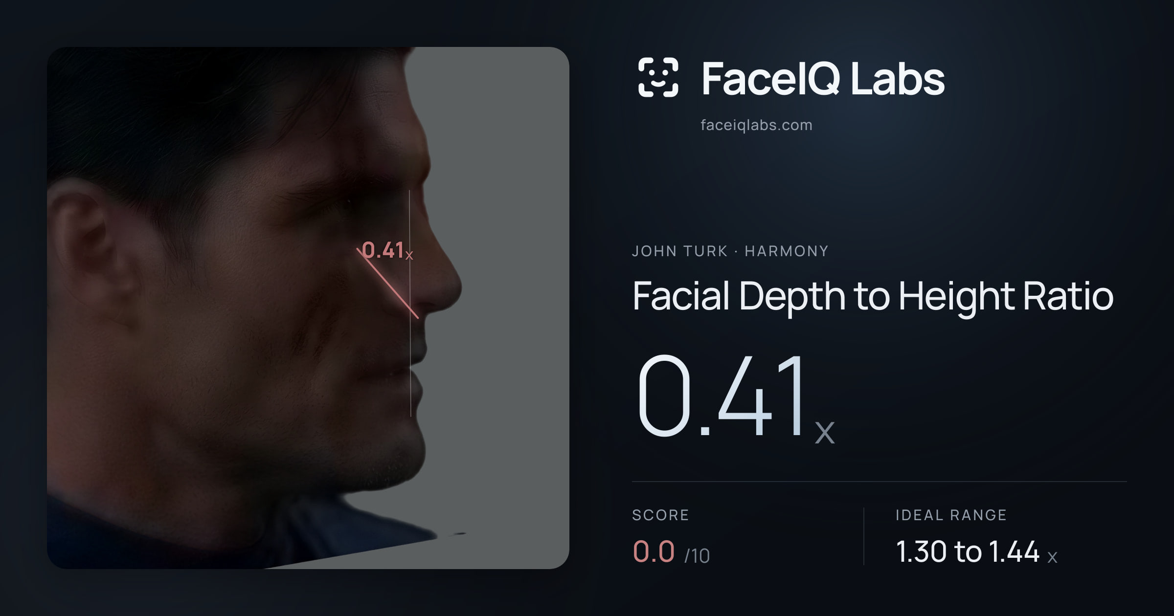 John Turk Facial Depth to Height Ratio: 0.41x, drawn on the photo