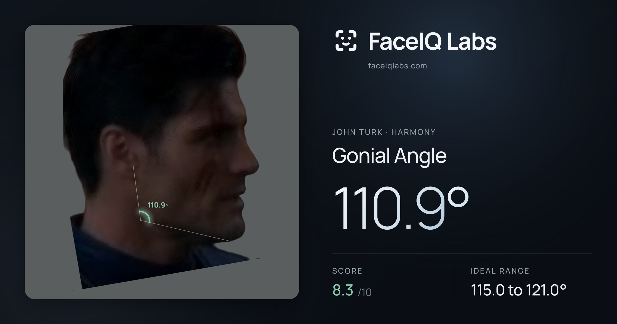 John Turk Gonial Angle: 110.9°, drawn on the photo