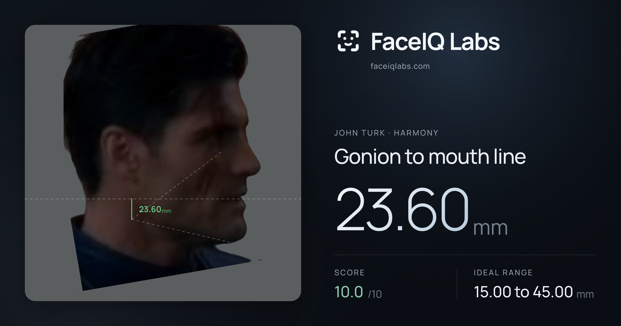 John Turk Gonion to mouth line: 23.60mm, drawn on the photo