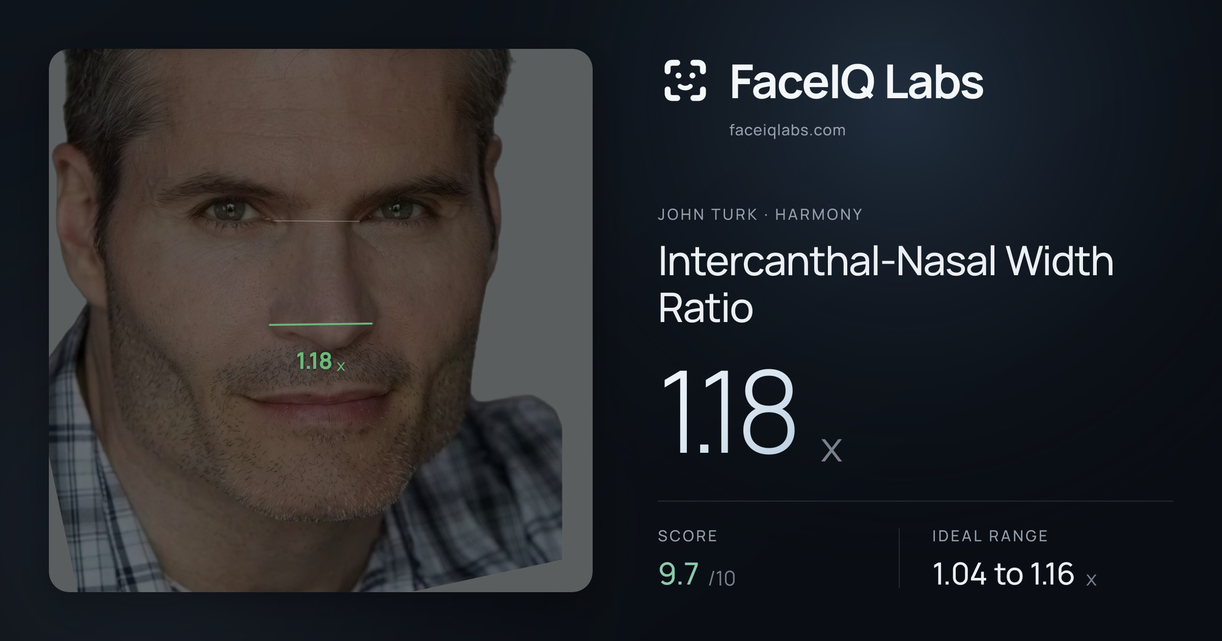 John Turk Intercanthal-Nasal Width Ratio: 1.18x, drawn on the photo
