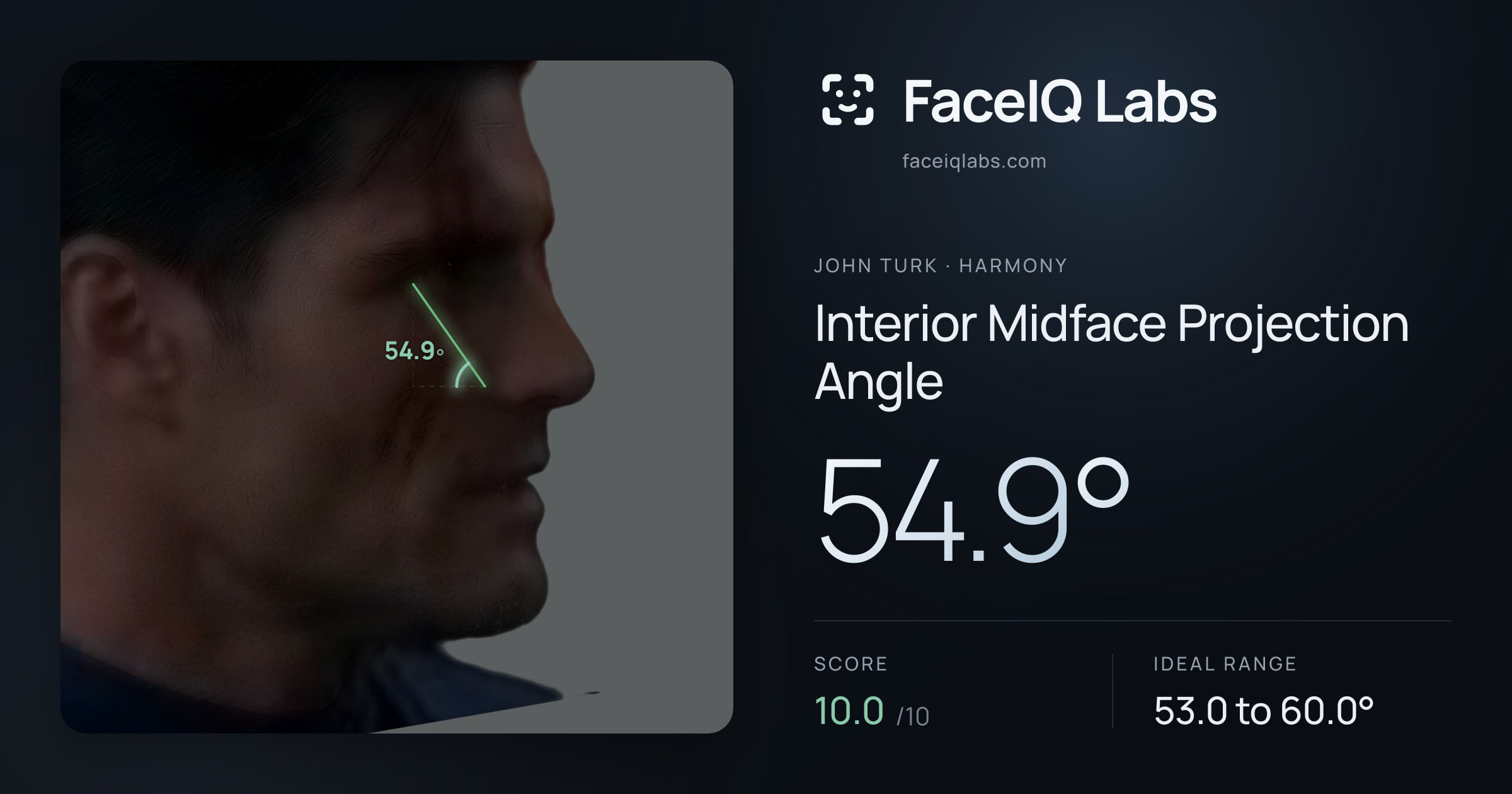 John Turk Interior Midface Projection Angle: 54.9°, drawn on the photo