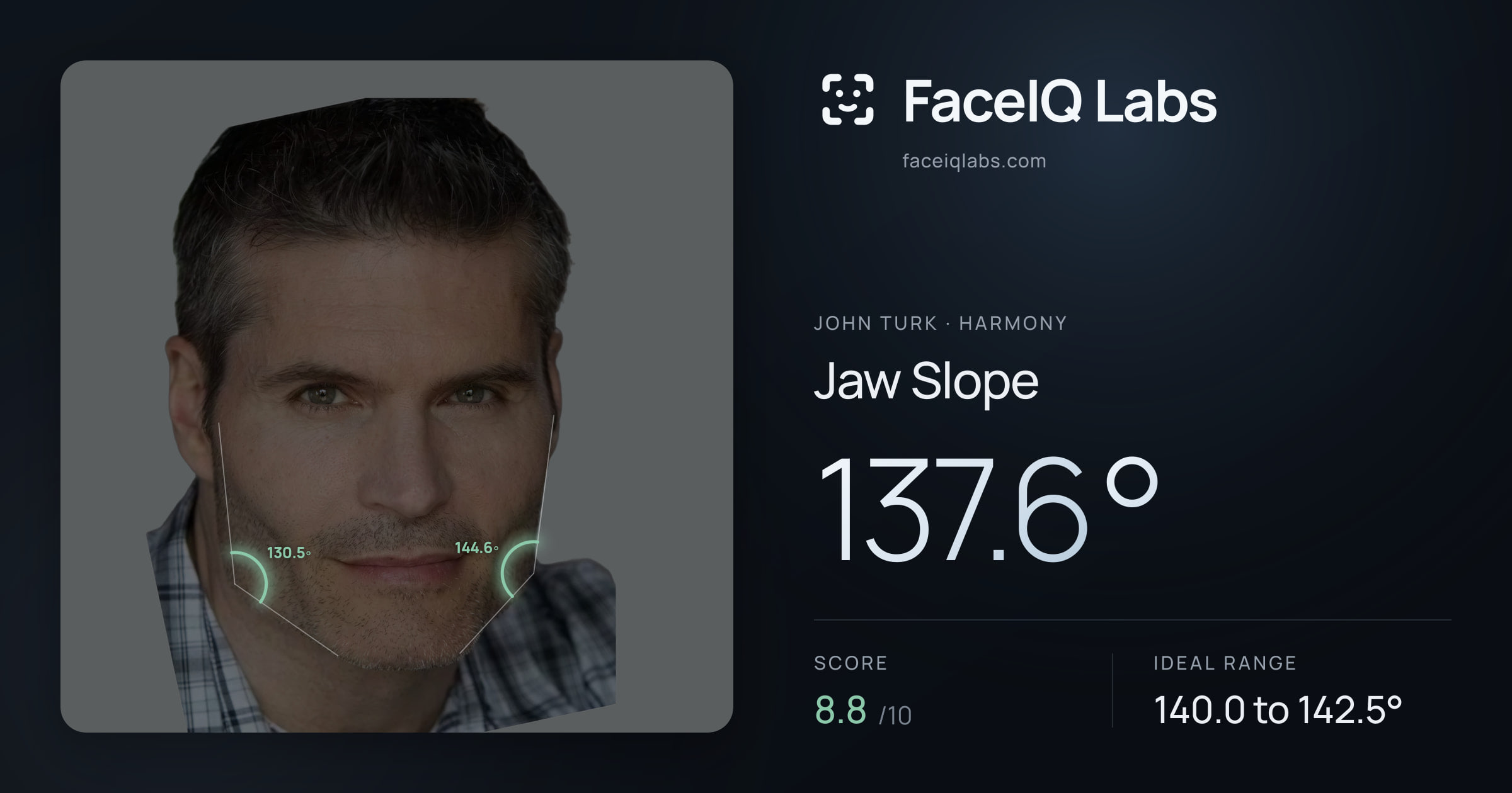 John Turk Jaw Slope: 137.6°, drawn on the photo