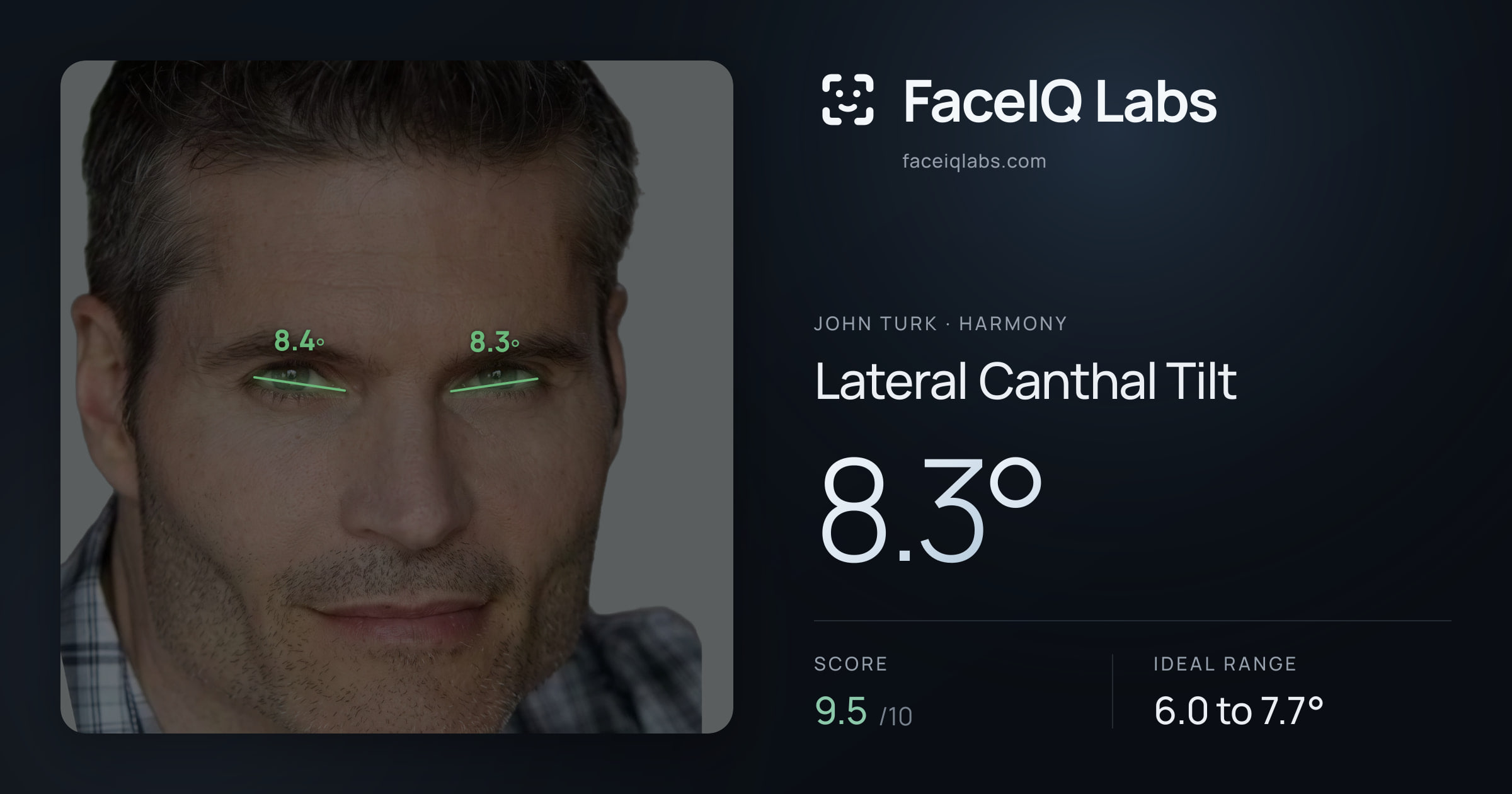 John Turk Lateral Canthal Tilt: 8.3°, drawn on the photo