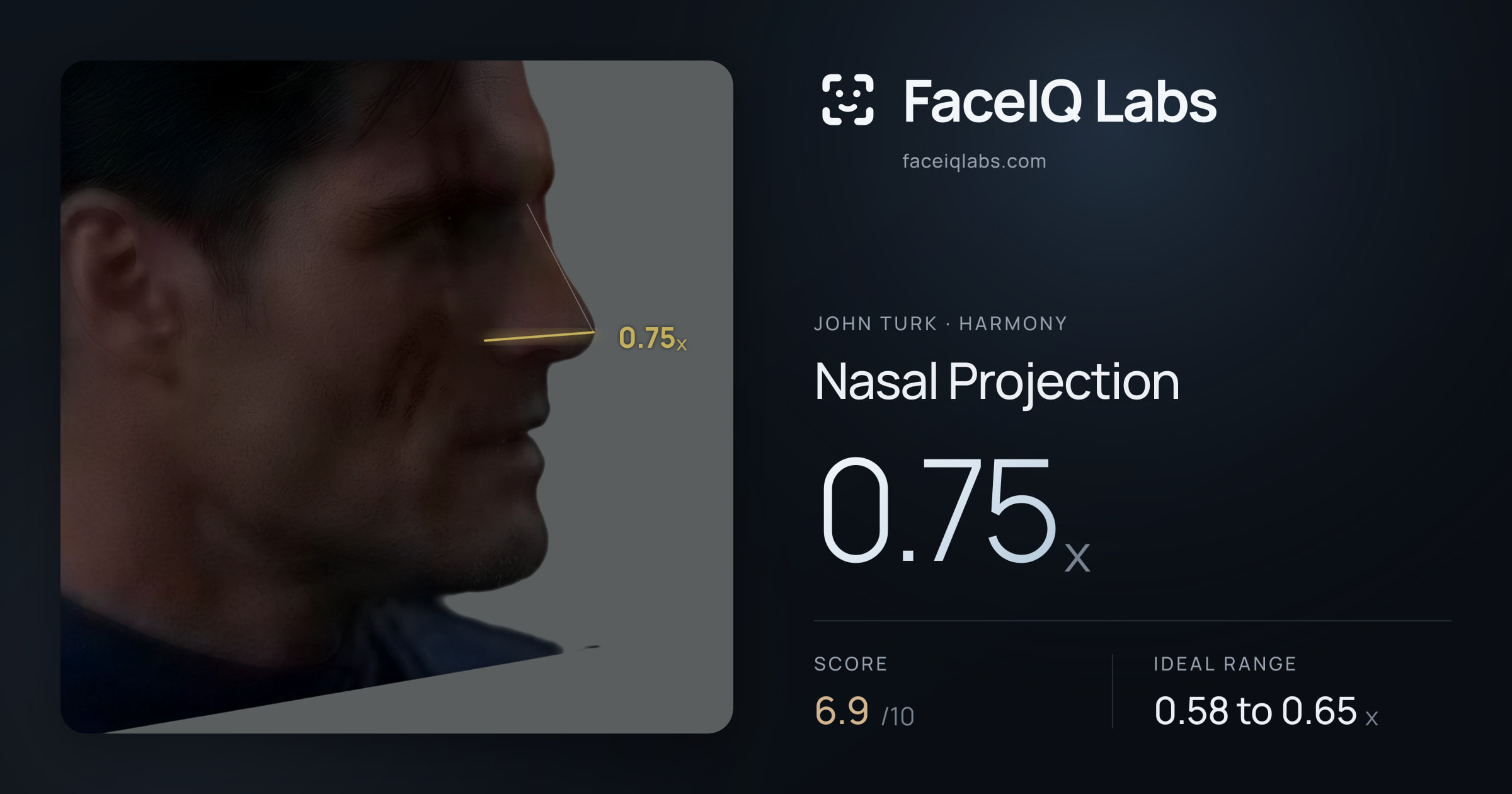John Turk Nasal Projection: 0.75x, drawn on the photo