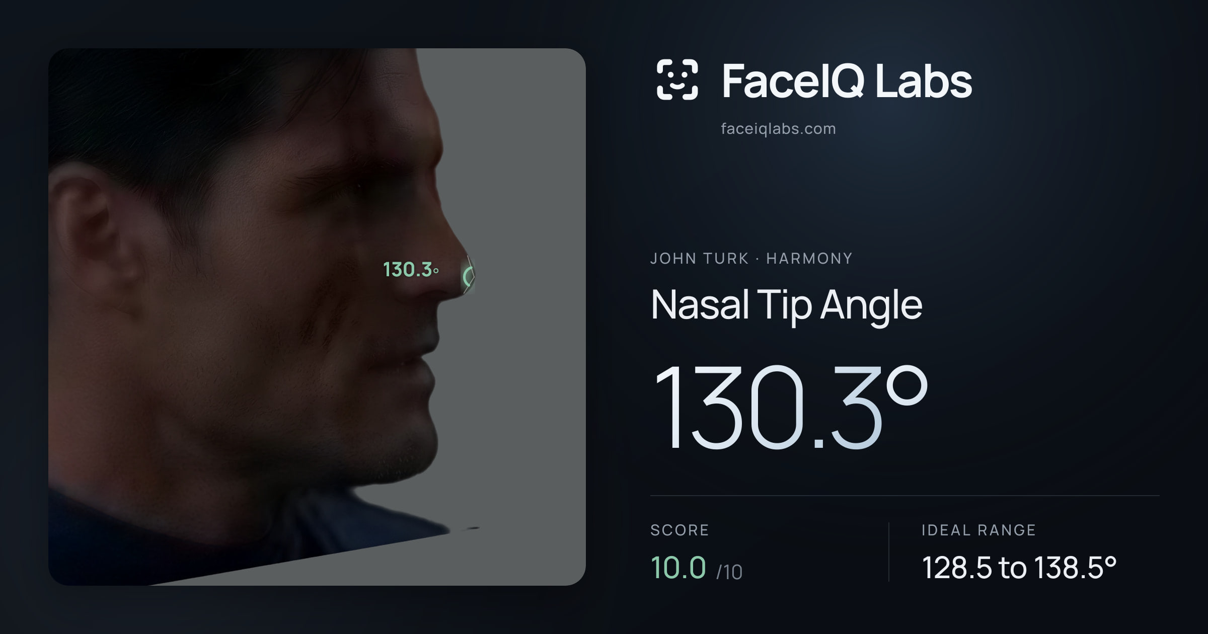 John Turk Nasal Tip Angle: 130.3°, drawn on the photo