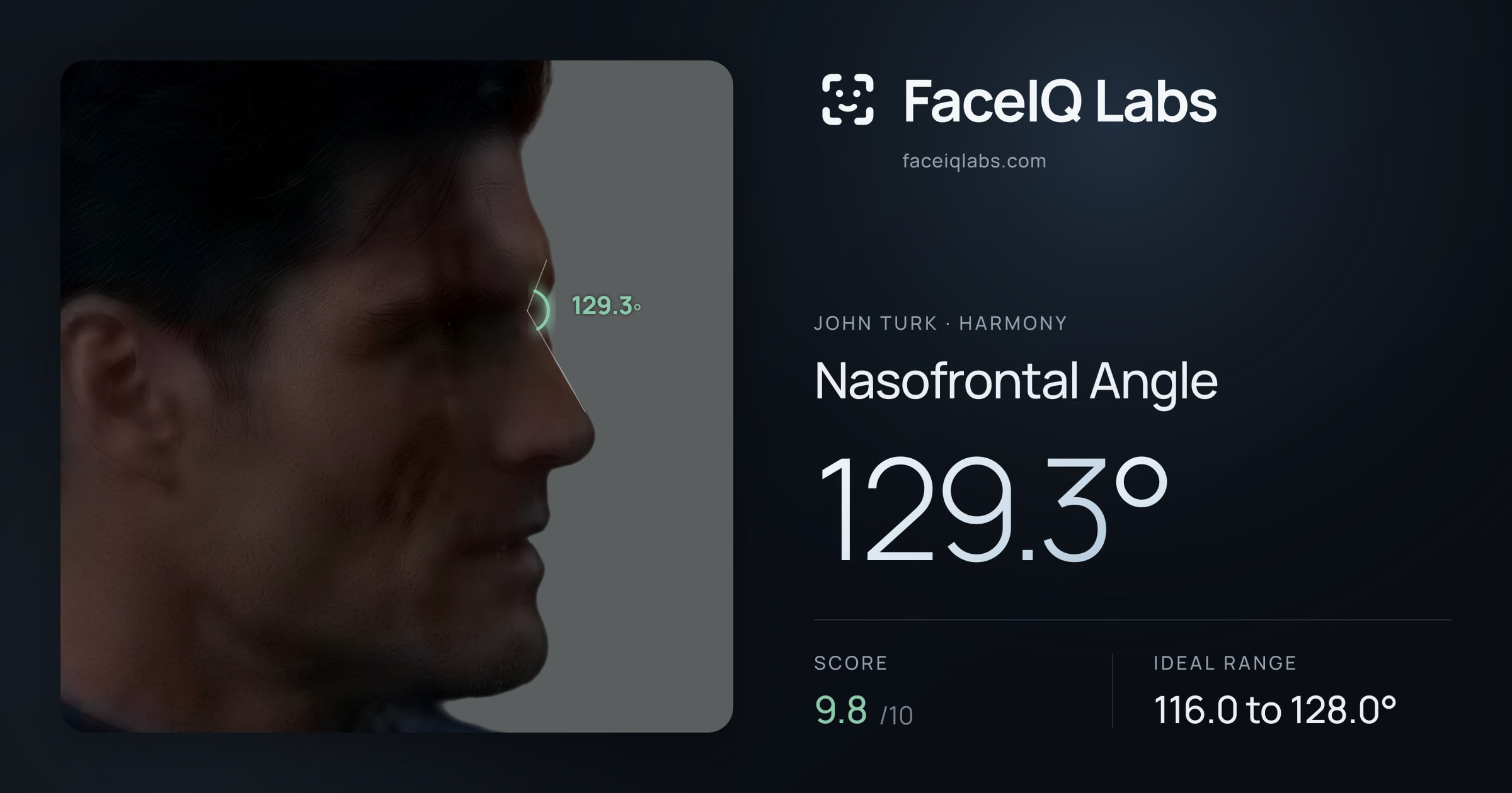 John Turk Nasofrontal Angle: 129.3°, drawn on the photo