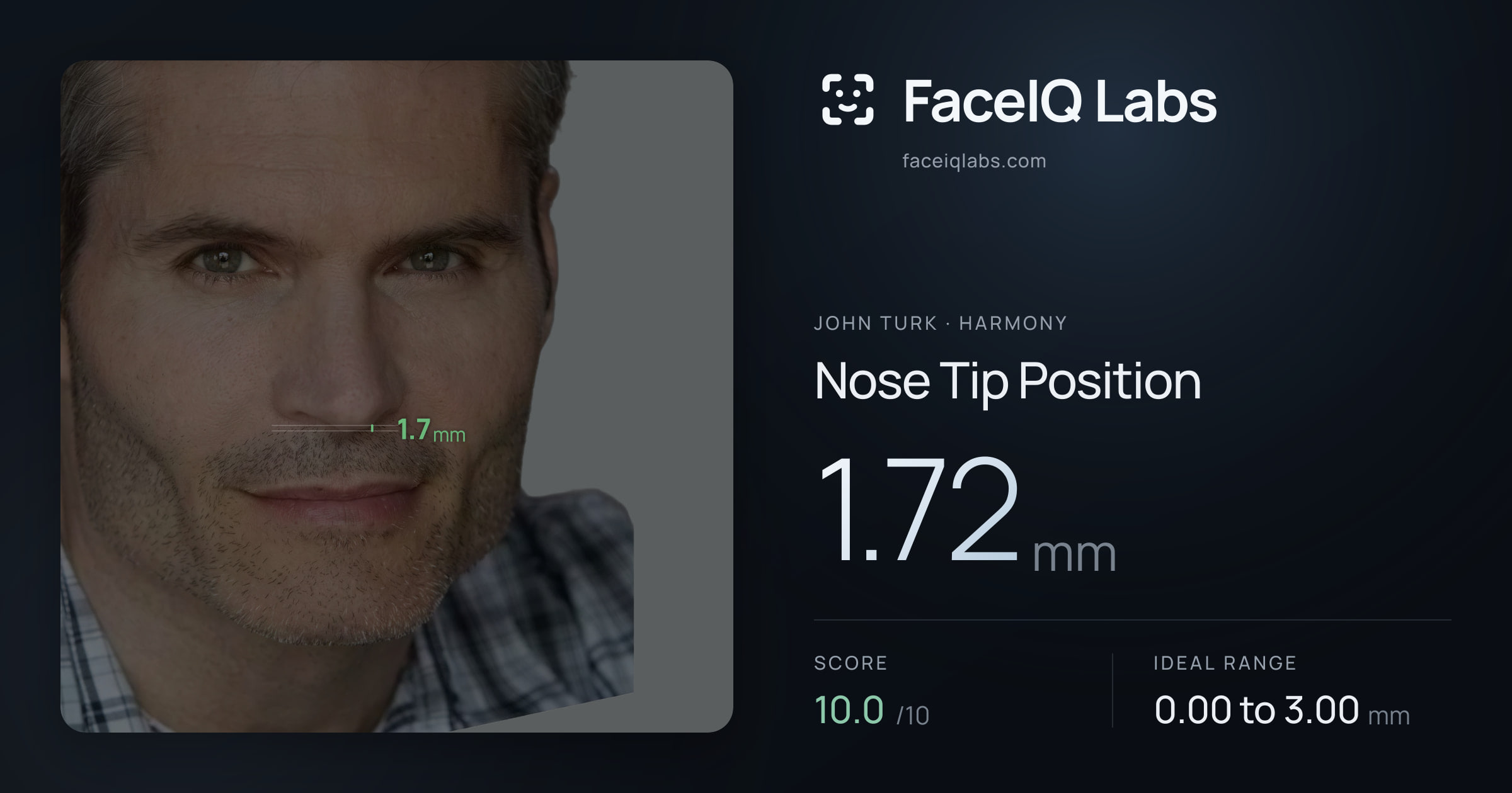 John Turk Nose Tip Position: 1.72mm, drawn on the photo