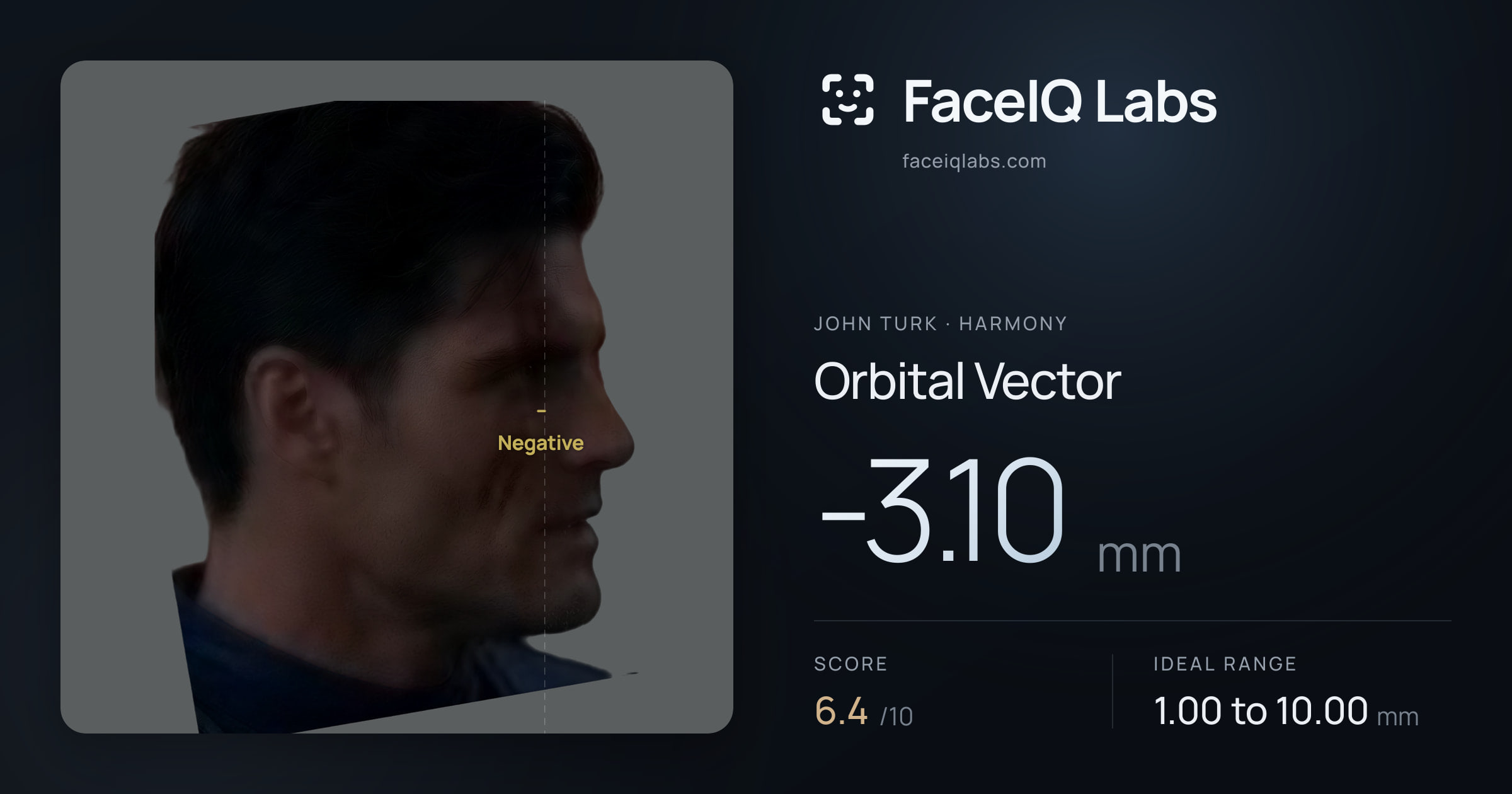John Turk Orbital Vector: -3.10mm, drawn on the photo