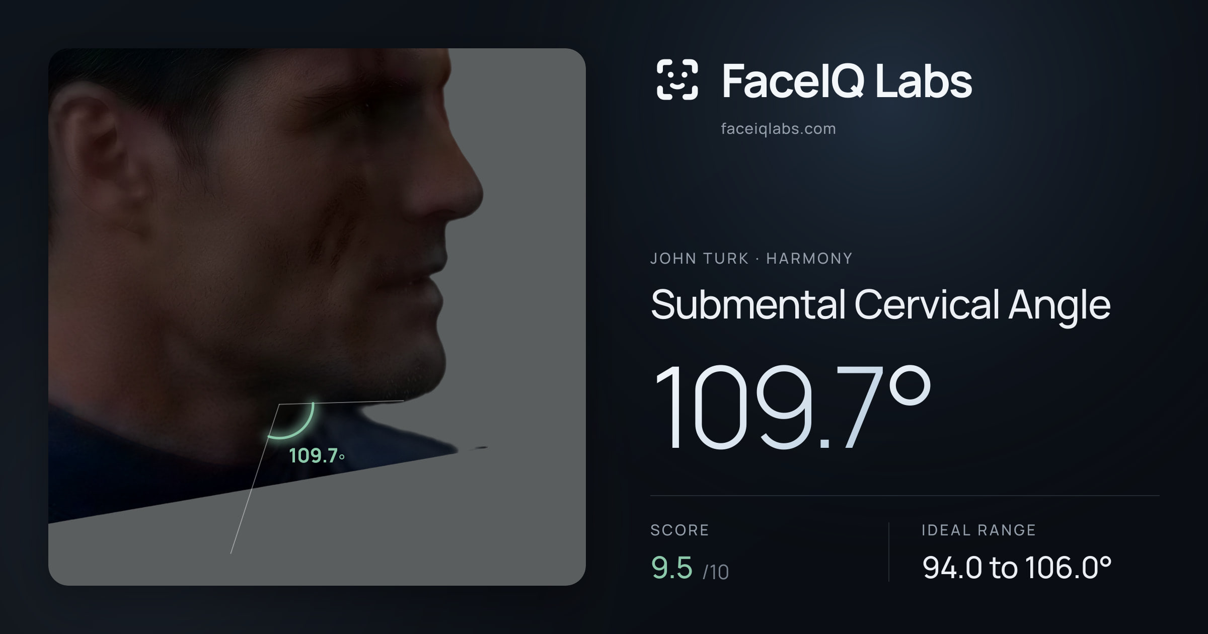John Turk Submental Cervical Angle: 109.7°, drawn on the photo