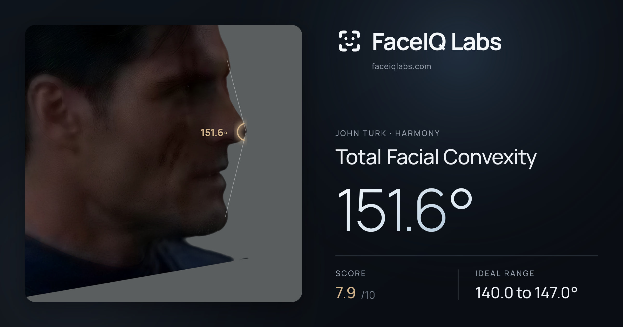 John Turk Total Facial Convexity: 151.6°, drawn on the photo
