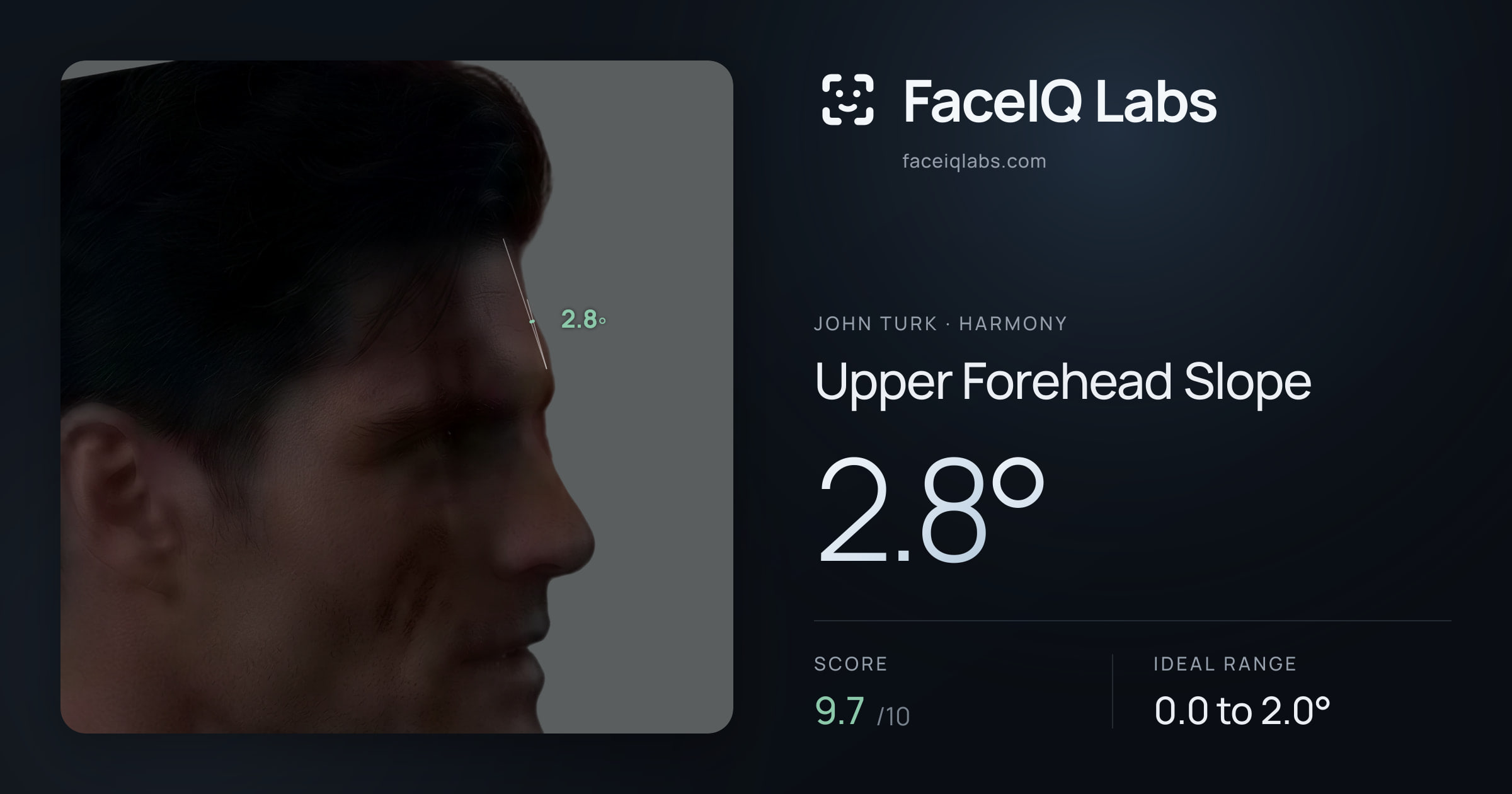 John Turk Upper Forehead Slope: 2.8°, drawn on the photo