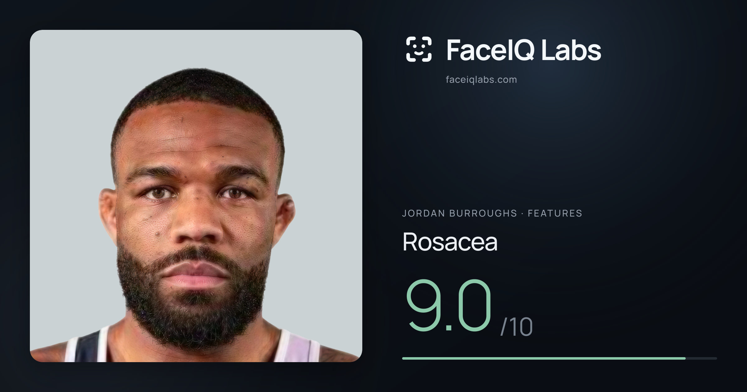 Jordan Burroughs Rosacea: 9.0/10, drawn on the photo
