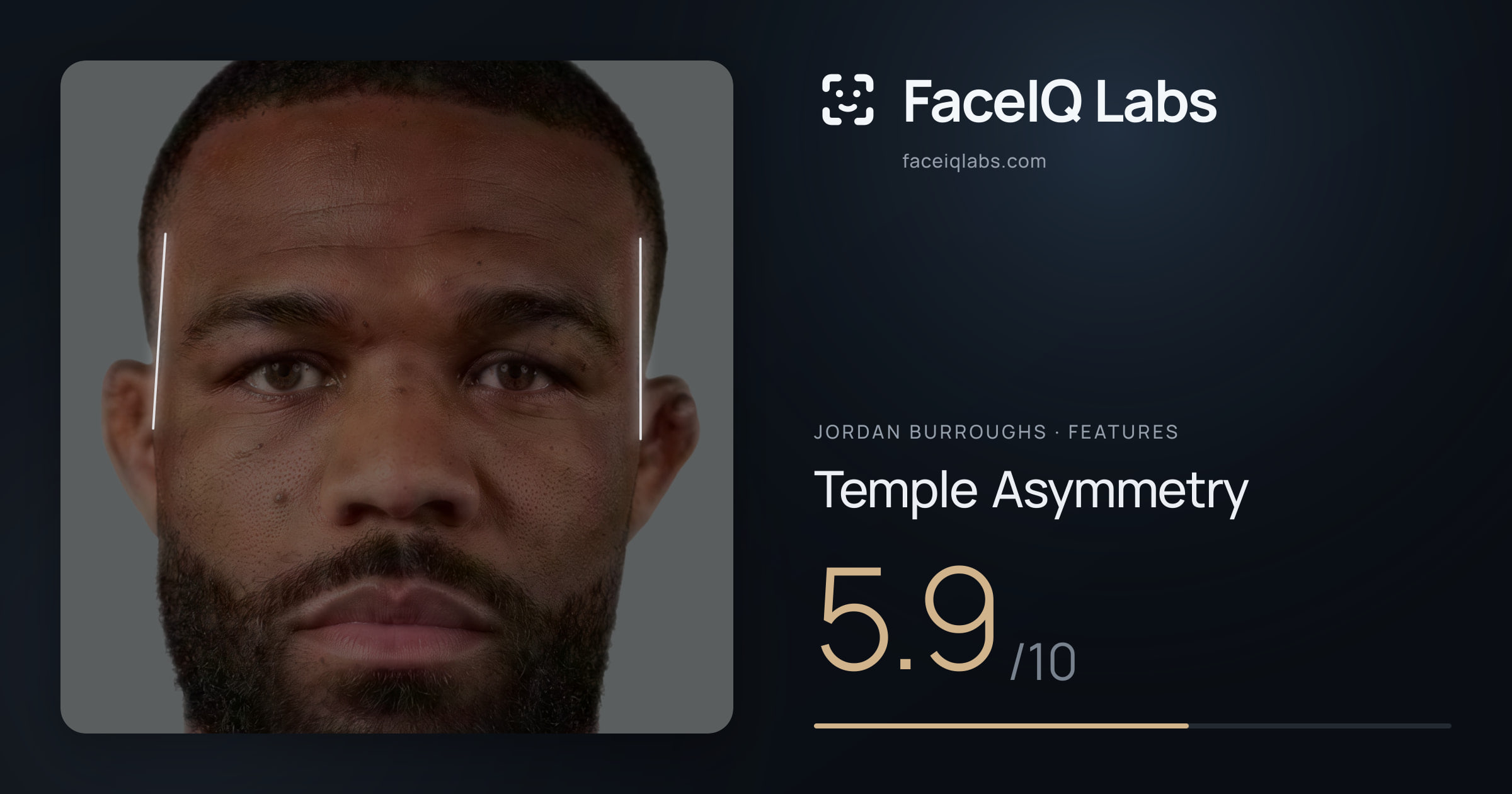 Jordan Burroughs Temple Asymmetry: 5.9/10, drawn on the photo