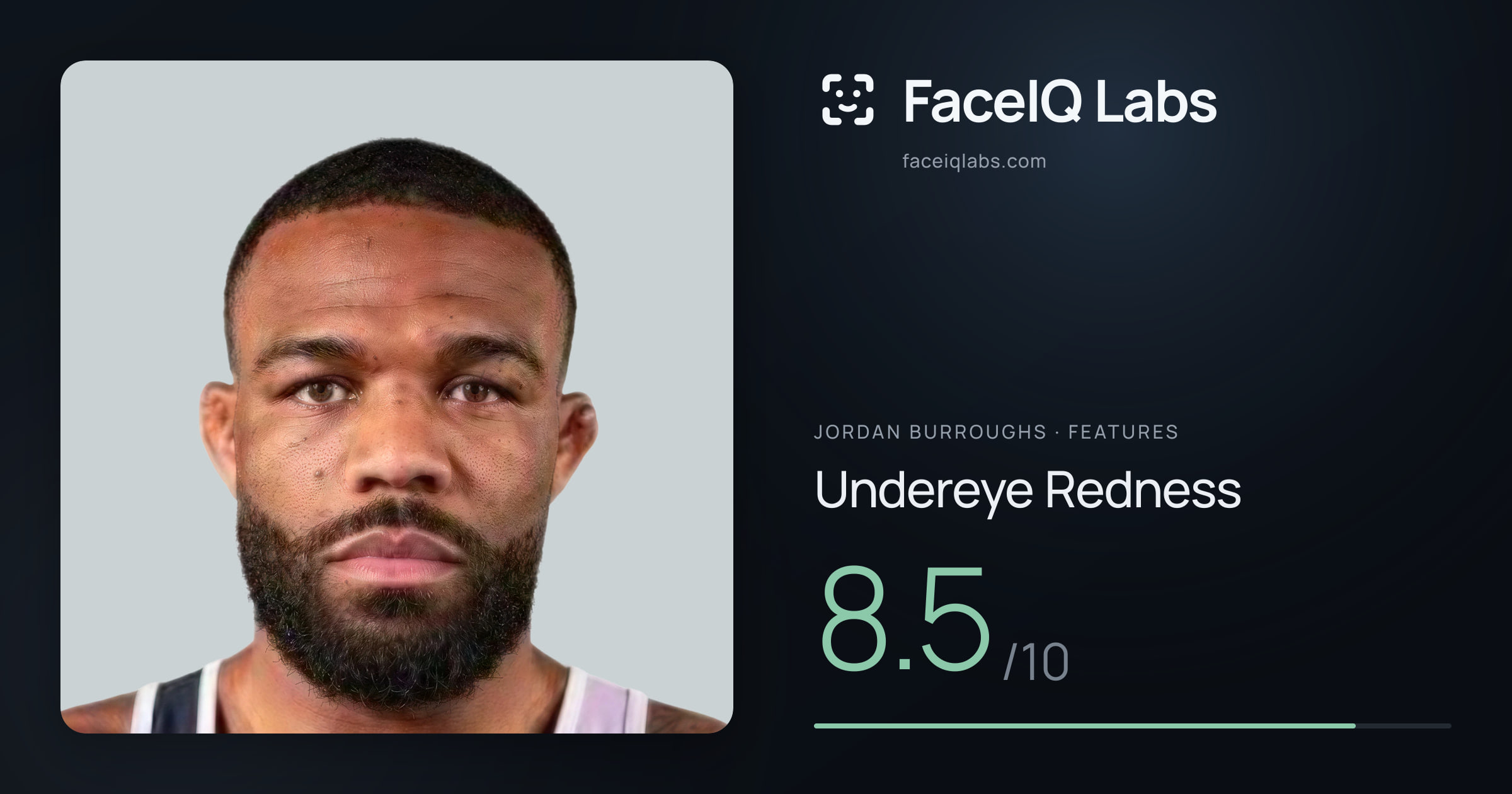 Jordan Burroughs Undereye Redness: 8.5/10, drawn on the photo