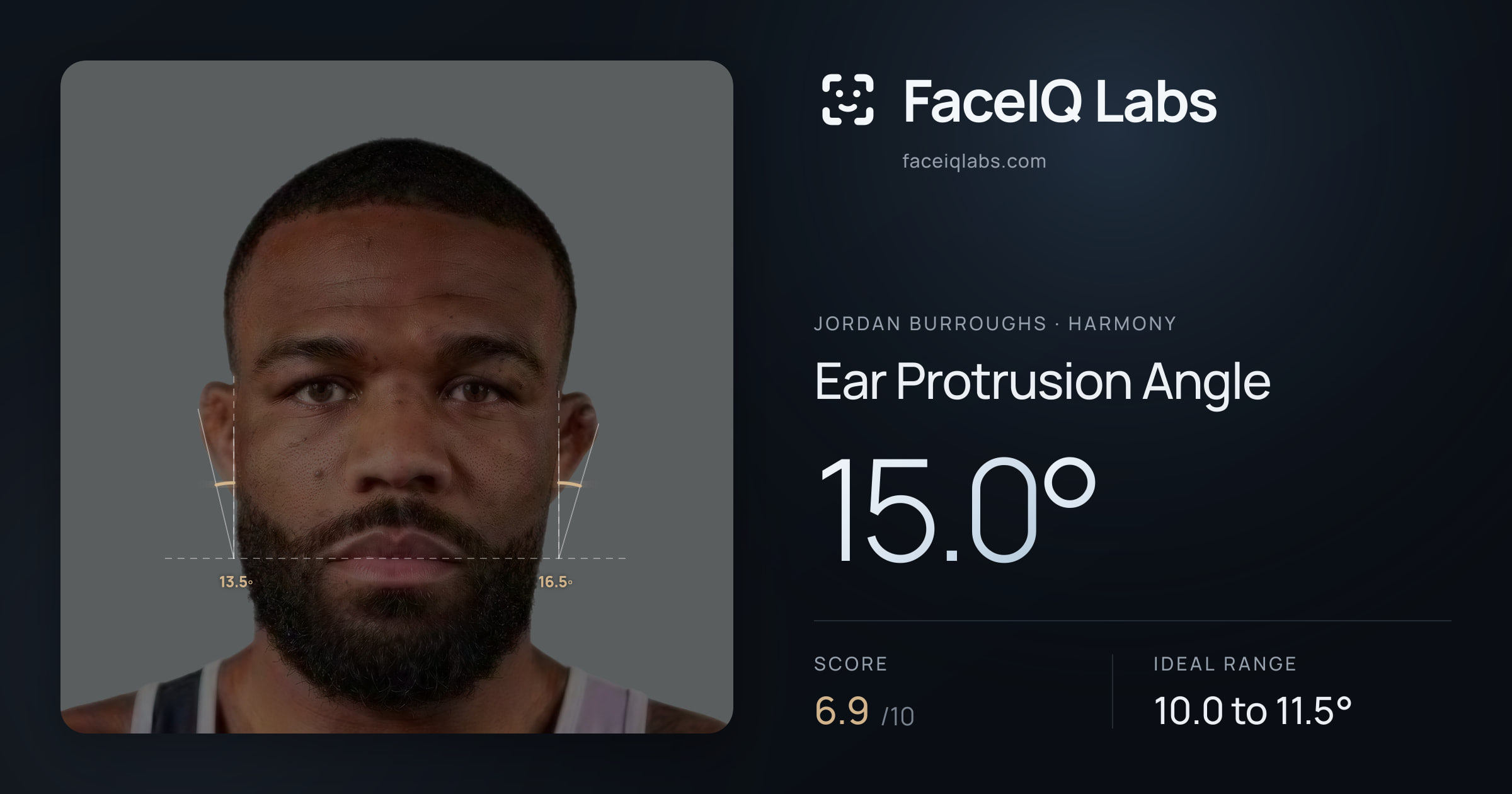 Jordan Burroughs Ear Protrusion Angle: 16.0°, drawn on the photo