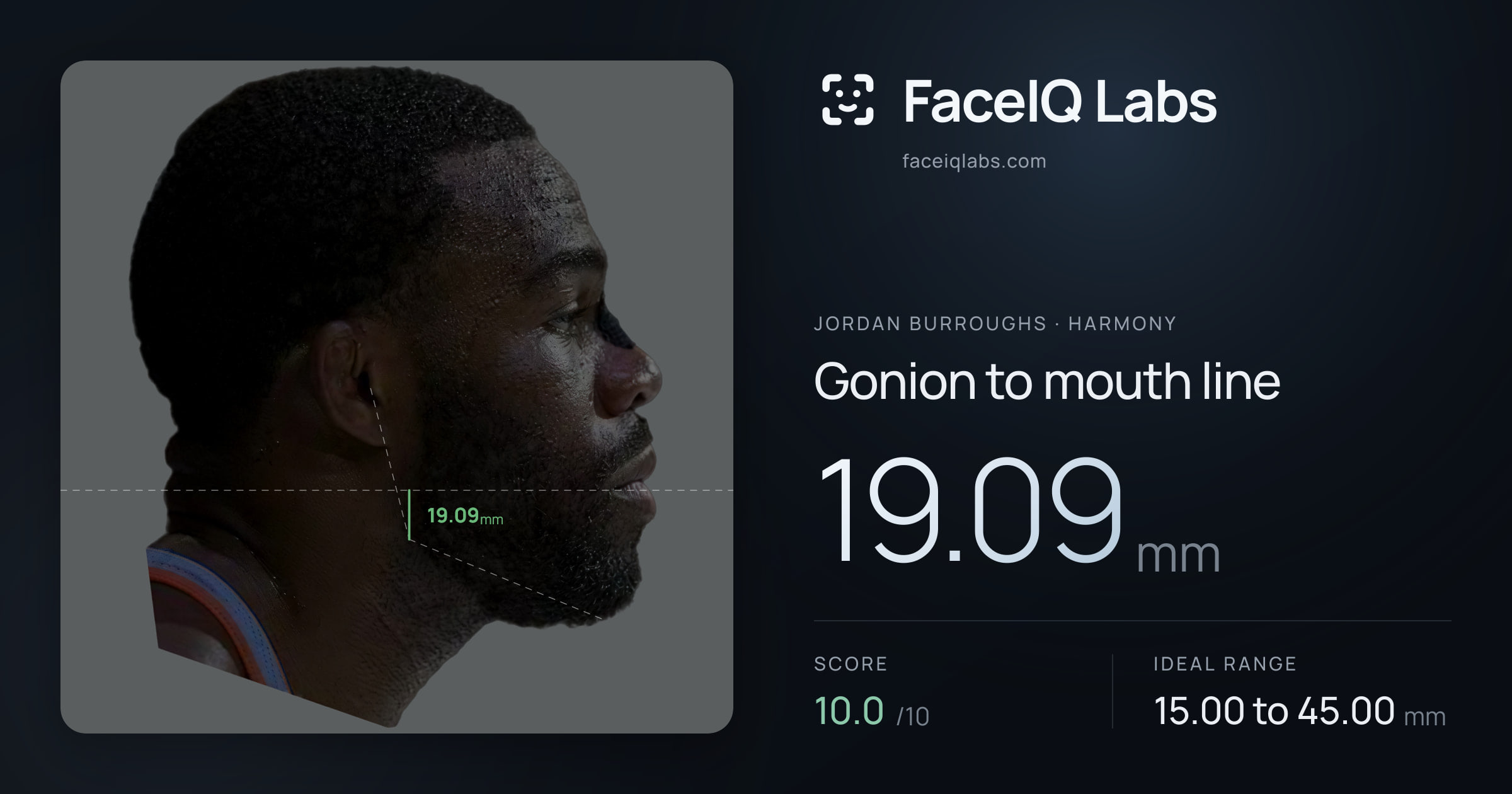 Jordan Burroughs Gonion to mouth line: 19.09mm, drawn on the photo