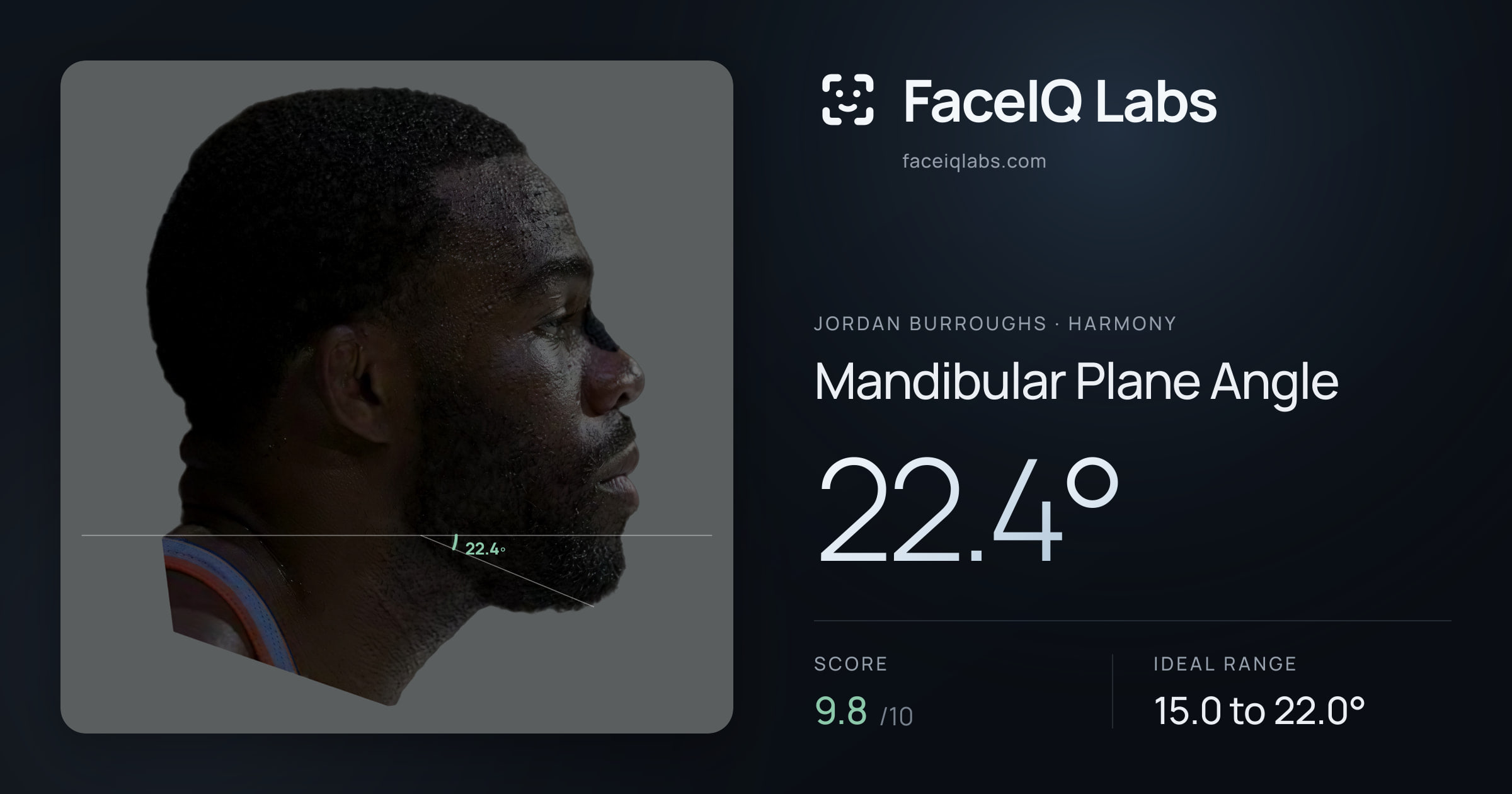 Jordan Burroughs Mandibular Plane Angle: 22.4°, drawn on the photo