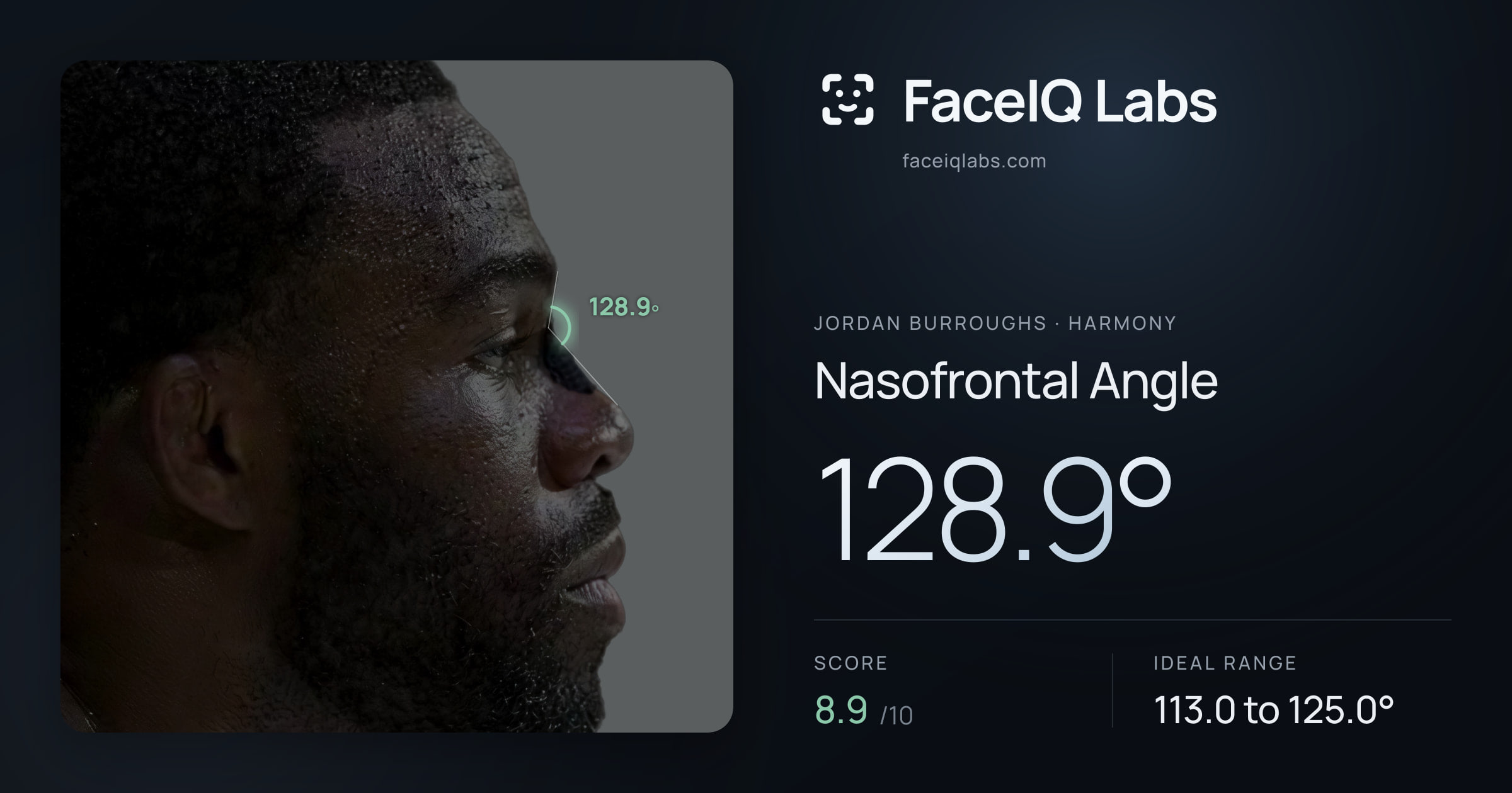 Jordan Burroughs Nasofrontal Angle: 128.9°, drawn on the photo