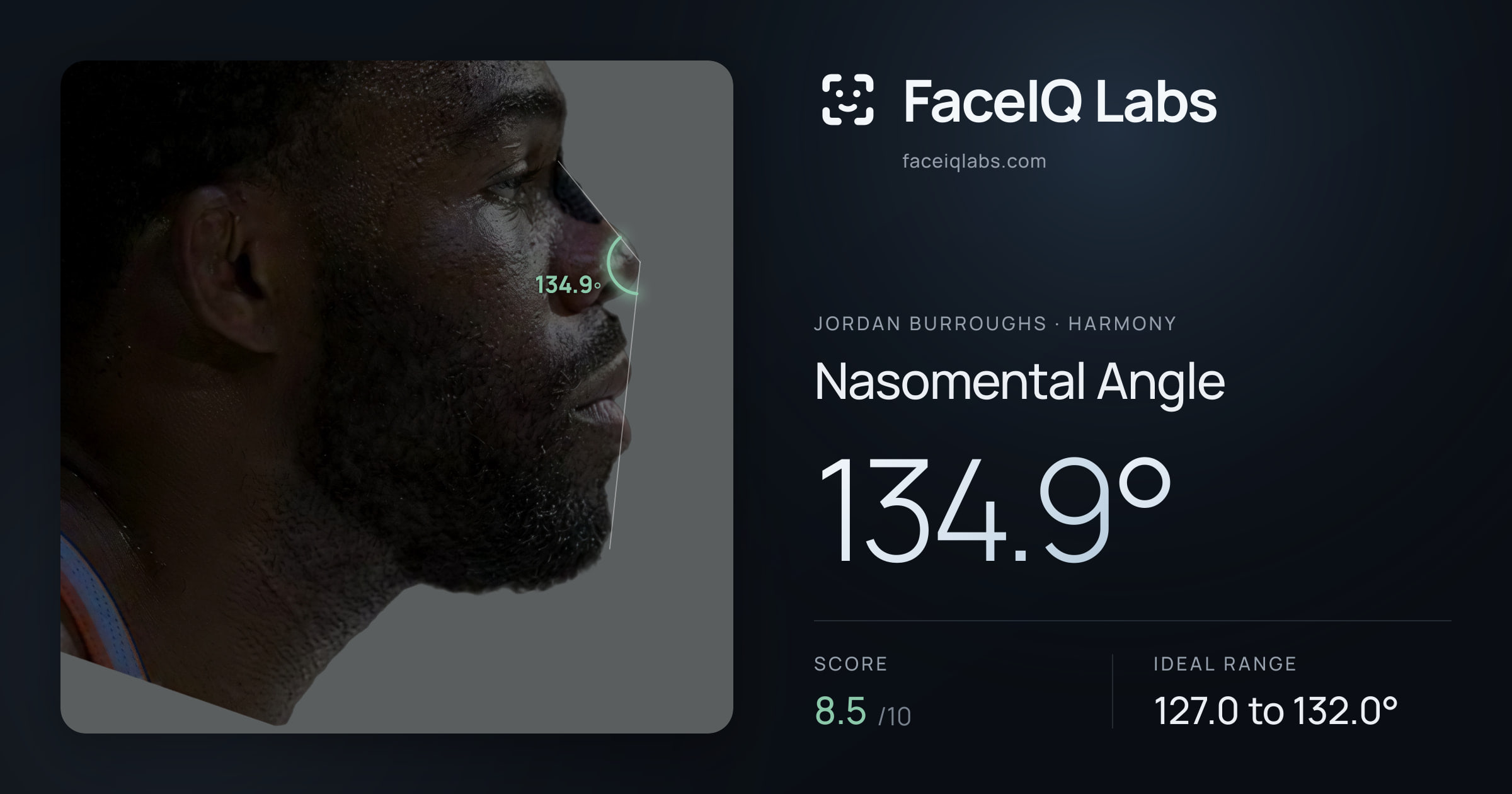 Jordan Burroughs Nasomental Angle: 134.9°, drawn on the photo