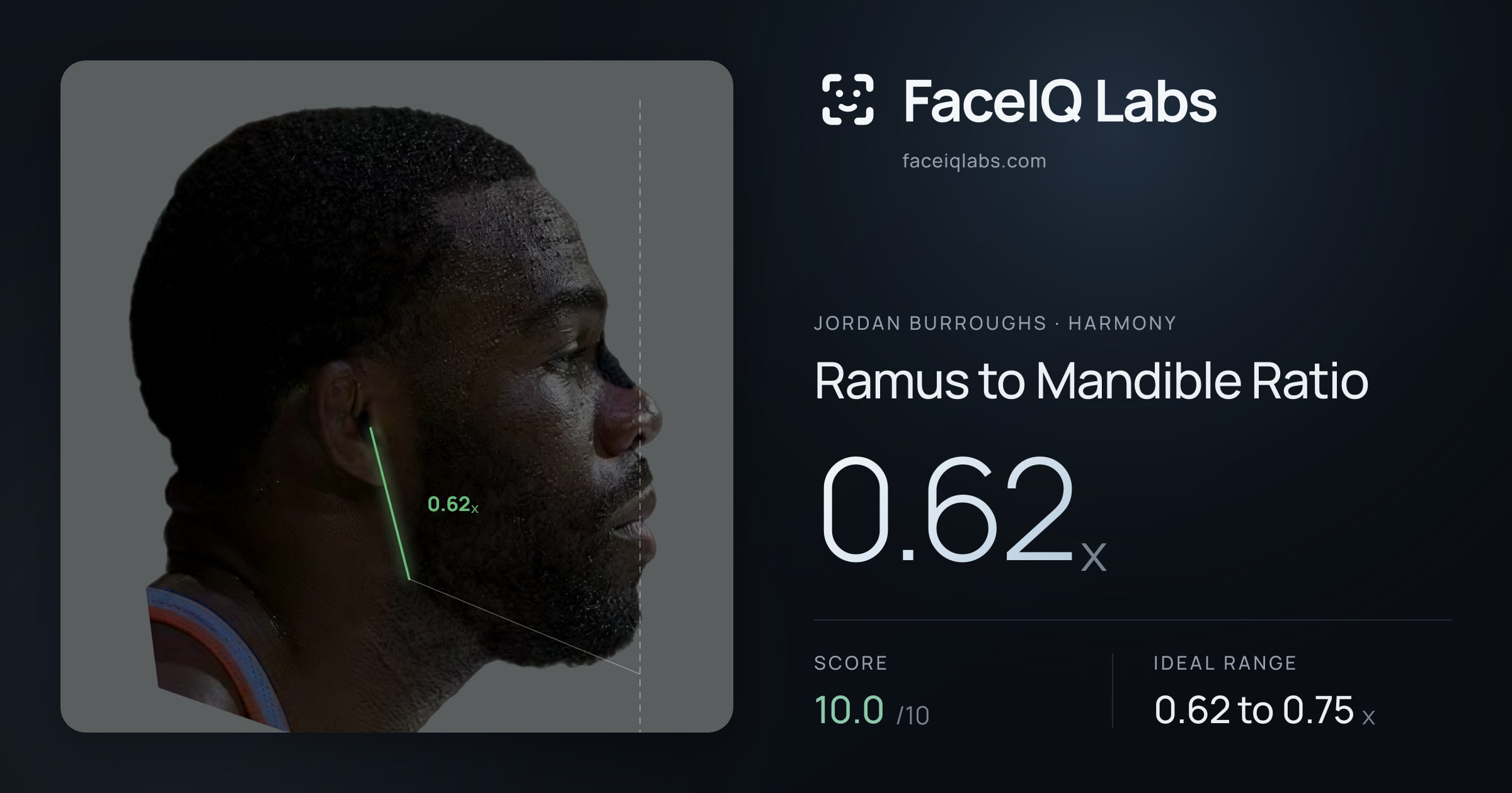 Jordan Burroughs Ramus to Mandible Ratio: 0.62x, drawn on the photo
