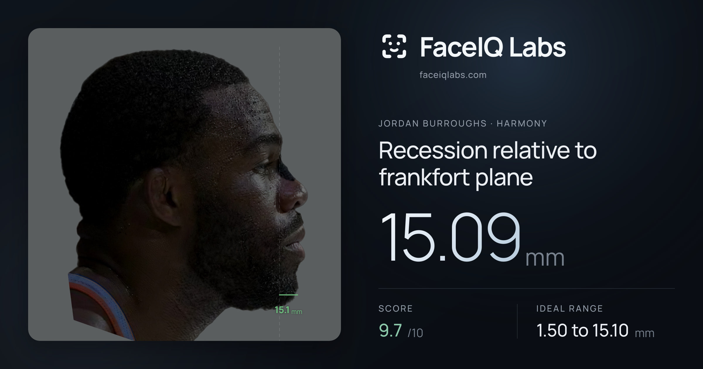 Jordan Burroughs Recession relative to frankfort plane: 15.09mm, drawn on the photo