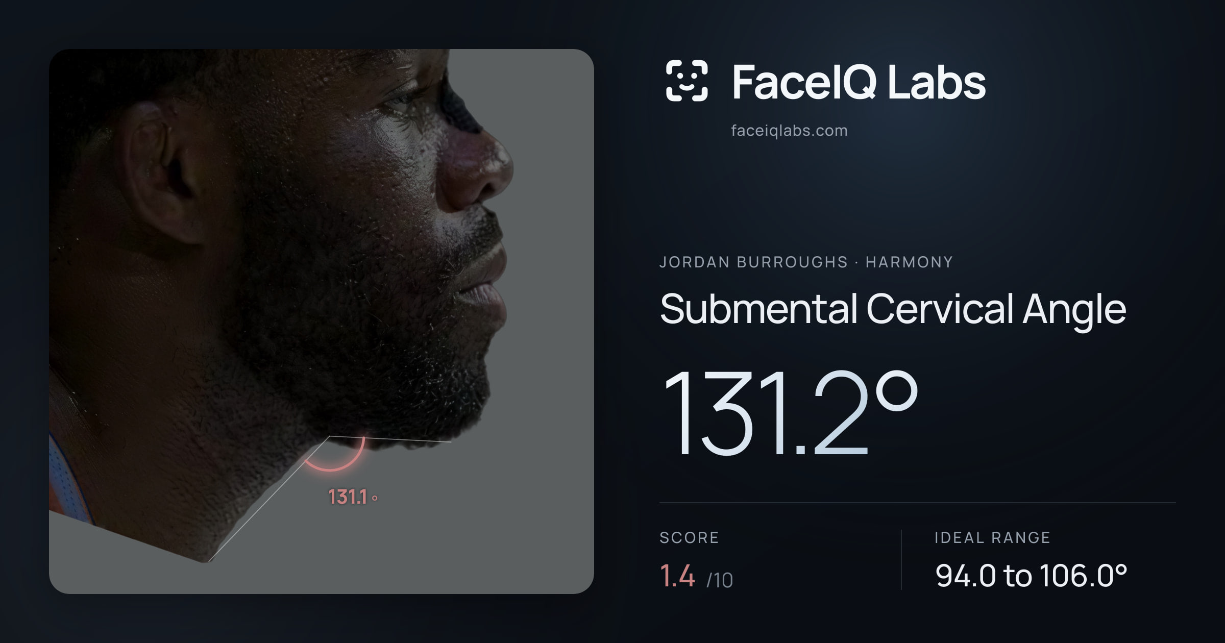 Jordan Burroughs Submental Cervical Angle: 131.2°, drawn on the photo
