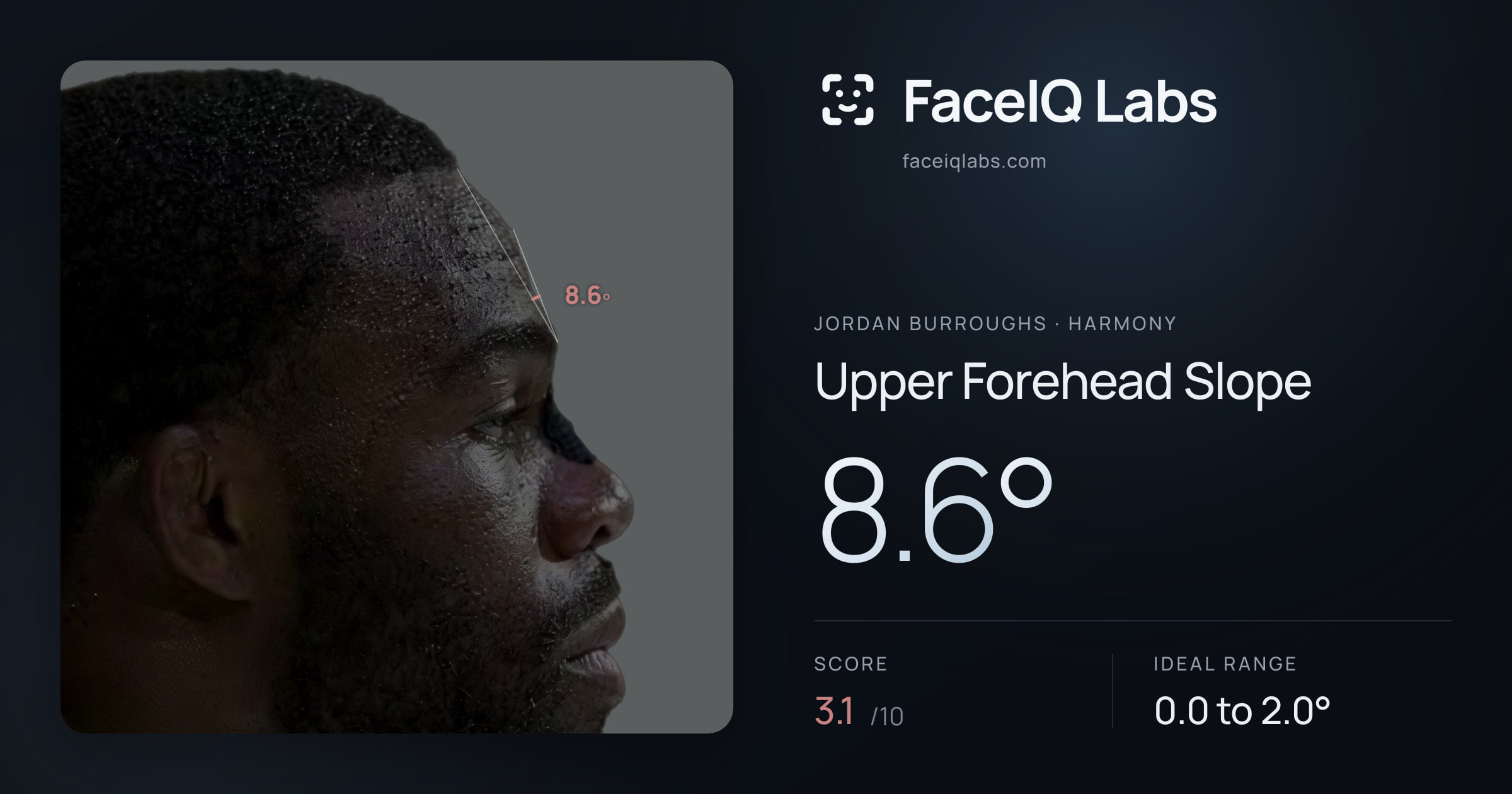 Jordan Burroughs Upper Forehead Slope: 8.6°, drawn on the photo